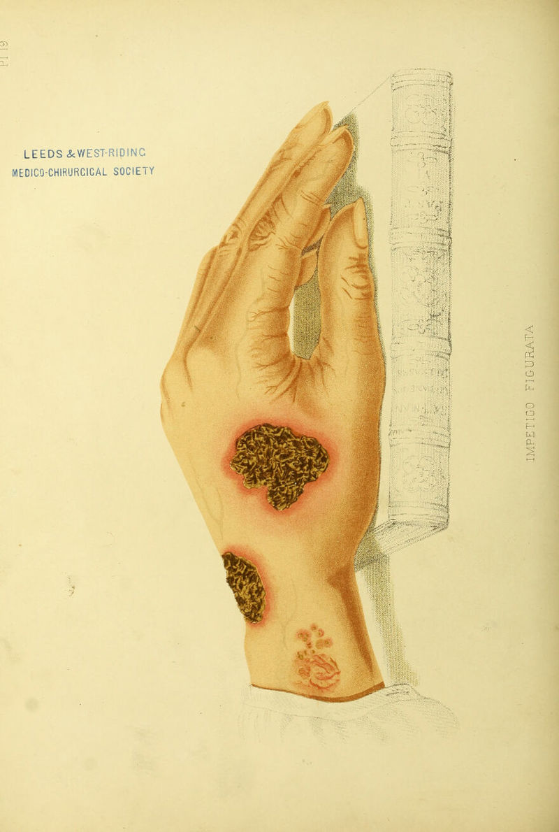 LEEDS .ScWEST-RipiNC MEDICO-CHIRURCICAL SOCIETY