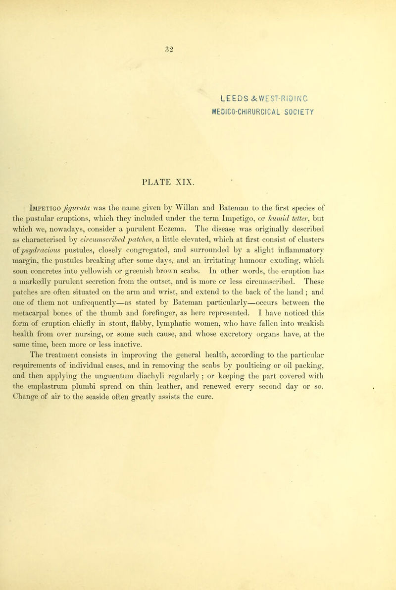 32 LEEDS <kWEST-RlDINC MEDICO-CHIRURGICAL SOCIETY PLATE XIX. Impetigo Jigurata was the name given by Willan and Bateman to the first species of the pustular eruptions, which they included under the term Impetigo, or humid tetter, but which we, nowadays, consider a purulent Eczema. The disease was originally described as characterised by circumscribed jyatches, a little elcA'^ated, which at first consist of clusters oi psydracious pustules, closely congregated, and surrounded by a slight inflammatory margin, the pustules breaking after some da}'s, and an irritating humour exuding, which soon concretes into yellowish or greenish brown scabs. In other words, the eruption has a markedly purulent secretion from the outset, and is more or less circumscribed. These patclies are often situated on the arm and wrist, and extend to the back of the hand ; and one of them not unfrequently—as stated by Bateman particularly—occurs between the metacarpal bones of the thumb and forefinger, as here represented. I have noticed this form of eruption chiefly m stout, flabby, lymphatic women, have fallen into weakish health from over nursing, or some such cause, and whose excretory organs have, at the same time, been more or less mactive. The treatment consists m improving the general health, according to the particular requirements of individual cases, and in removing the scabs by poulticing or oil packing, and then applymg the unguentum diachyli regularly; or keepmg the part covered with the emplastrum plumbi spread on thm leather, and renewed every second day or so. Change of air to the seaside often greatly assists the cure.