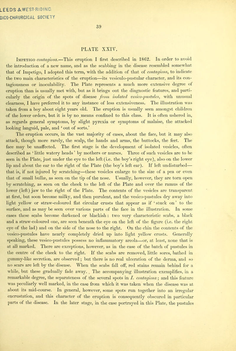DICO-CHIRURCICAL SOCIETY 39 PLATE XXIV. Impetigo contagiosa.—This eruption I first described in 1862. In order to avoid the introduction of a new name, and as the scabbing in the disease resembled somewhat that of Impetigo, I adopted this term, with the addition of that of contagiosa^ to indicate the two main characteristics of the eruption—its vesiculo-pustular character, and its con- tagiousness or inoculability. The Plate represents a much more extensive degree of eruption than is usually met with, but as it brings out the diagnostic features, and parti- cularly the origin of the spots of disease from isolated vesico-pustules^ with unusual clearness, I have preferred it to any instance of less extensiveness. The illustration was taken from a boy about eight years old. The eruption is usually seen amongst children of the lower orders, but it is by no means confined to this class. It is often ushered in, as regards general symptoms, by slight pyrexia or symptoms of malaise, the attacked looking languid, pale, and ' out of sorts.' The eruption occurs, in the vast majority of cases, about the face, but it may also attack, though more rarely, the scalp, the hands and arms, the buttocks, the feet. The face may be unaffected. The first stage is the development of isolated vesicles, often described as ' little watery heads' by mothers or nurses. Three of such vesicles are to be seen m the Plate, just under the eye to the left (i.e. the boy's right eye), also on the lower lip and about the ear to the right of the Plate (the boy's left ear). If left undisturbed— that is, if not injured by scratching—these vesicles enlarge to the size of a pea or even that of small bullse, as seen on the tip of the nose. Usually, however, they are torn open by scratching, as seen on the cheek to the left of the Plate and over the ramus of the lower (left) jaw to the right of the Plate. The contents of the vesicles are transparent at first, but soon become milky, and then purulent, and the vesico-pustules dry away into light yellow or straw-coloured flat circular crusts that appear as if ' stuck on' to the surface, and as may be seen over various parts of the face in the illustration. In some cases these scabs become darkened or blackish : two very characteristic scabs, a black and a straw-coloiu-ed one, are seen beneath the eye on the left of the figure (i.e. the right eye of the lad) and on the side of the nose to the right. On the chin the contents of the vesico-pustules have nearly completely dried up into light yellow crusts. Generally speaking, these vesico-pustules possess no inflammatory areola—or, at least, none that is at all- marked. There are exceptions, however, as in the case of the batch of pustules in the centre of the cheek to the right. If the scabs are removed, little sores, bathed in gummy-like secretion, are observed; but there is no real ulceration of the derma, and so no scars are left by the disease. When the scabs fall ofl, red stains remam behind for a while, but these gradually fade away. . The accompanymg illustration exemplifies, in a remarkable degree, the separateness of the several spots in /. contagiosa ; and this feature was peculiarly well marked, m the case fi-om which it was taken when the disease was at about its mid-com-se. In general, however, some spots run together into an irregxilar encrustation, and this character of the eruption is consequently obscured in particular parts of the disease. In the later stage, in the case portrayed in this Plate, the pustules