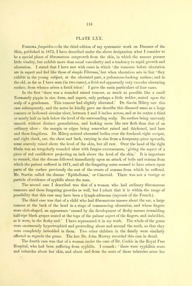 PLATE LXX. Fibroma fungoides.—In the third edition of my systematic work on Diseases of the Skin, published in 1873, I have described under the above designation what I consider to be a special phase of fibromatous outgrowth from the skin, in which the masses possess little vitality, but exhibit more than usual vascularity and a tendency to rapid growth and ulceration. I stated that I have met with cases in which ' the tumours before ulceration are in aspect and feel like those of simple Fibroma,' but when ulceration sets in that ' they exhibit in the young subject, at the ulcerated part, a pultaceous-looking surface; and in the old, as far as I have seen (in two cases), a livid-red apparently very vascular ulcerating surface, from whence arises a foetid ichor.' I gave the main particulars of four cases. In the first ' there was a rounded raised tumour, as much as possible like a small Normandy pippin in size, form, and aspect, only perhaps a little redder, seated upon the scalp of a gentleman. This tumour had slightly ulcerated.' Dr. Gavin Milroy saw this case subsequently, and the notes he kindly gave me describe this diseased mass as a large concave or hollowed cu'cular ulcer, between 2 and 3 inches across, and at its centre a third or nearly half an inch below the level of the surrounding scalp. Its surface being unevenly smooth without distinct granulations, and looking more like raw flesh than that of an ordinary ulcer : the margin or edges bemg somewhat raised and thickened, and here and there fungiform. Dr. Milroy noticed ulcerated bodies over the forehead, right occiput, and right cheek, ear, the chest and back, varying in size from a fourpenny-piece upwards, some scarcely raised above the level of the skin, but all raw. Over the head of the right fibula was an irregularly rounded ulcer with fungus excrescences, ' giving the aspect of a piece of red cauliflower projecting an inch above the level of the skin.' It is important to remark, that the disease followed immediately upon an attack of boils and eczema from which the patient suffered in 1871, and all the fungating sores seemed to have arisen upon parts of the surface previously the seat of the crusts of eczema from which he suffered. Mr. Startin called the disease ' Epithelioma,' or Cancroid. There was not a vestige or particle of evidence of syphilis about the man. The second case I described was that of a woman who had ordinary fibromatous tumours and these fungating growths as well, but I admit that it is within the range of possibility that this case may have been a lymph-adenoma (mycosis of the French). The thu'd case was that of a child who had fibromatous masses about the ear, a large tumour at the back of the head in a stage of commencing ulceration, and whose fingers were club-shaped, an appearance ' caused by the development of fleshy masses resembling half-ripe black grapes seated at the tops of the palmar aspect of the fingers, and imbedded, as it were, in the fleshy end.' I have represented it in my work. The whole of the gums were enormously hypertrophied and protruding about and around the teeth, so that they were completely imbedded in them. Two other children in the family were similarly affected as regards the gums. The late Dr. Jolm Murray recorded this case in detail. The fourth case was that of a woman under the care of Dr. Cockle in the Royal Free Hospital, who had been suffering from syphilis. I remark : ' there were syphilitic scars and tubercles about her skin, and about and from the seats of these tubercles arose lax