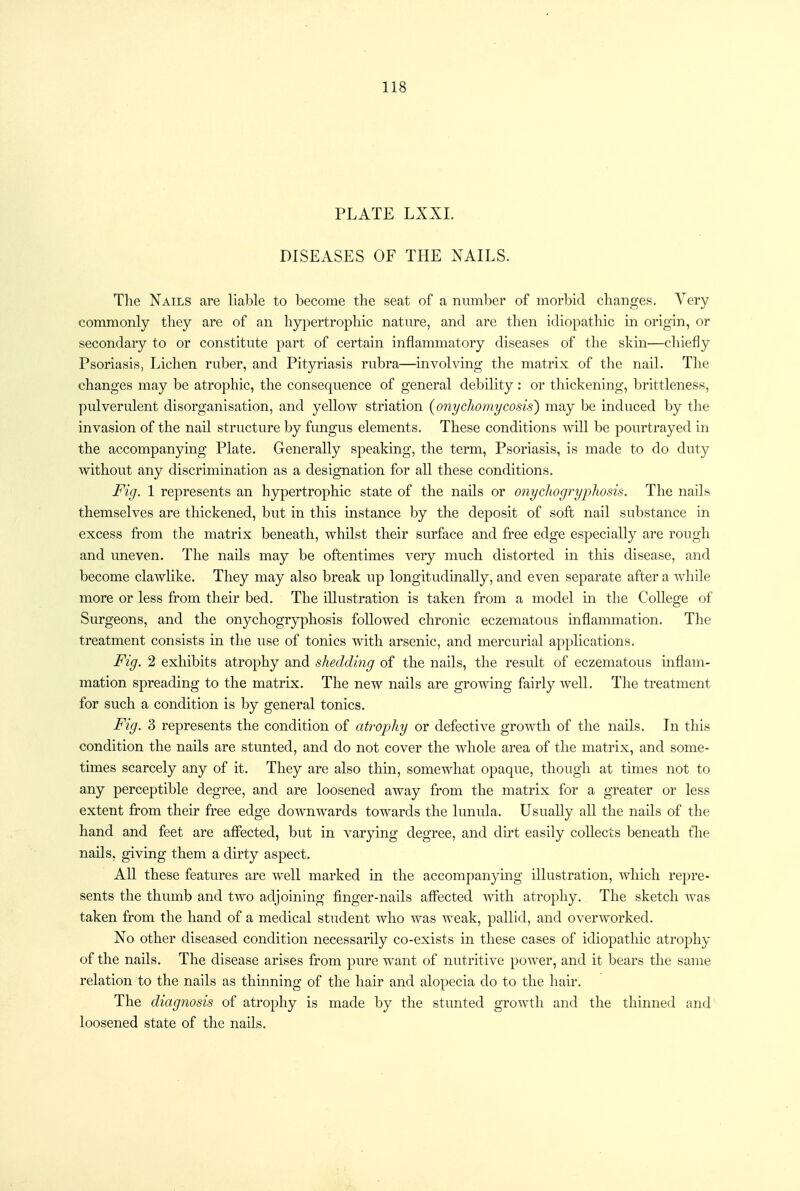 PLATE LXXI. DISEASES OF THE NAILS. The Nails are liable to become the seat of a number of morbid changes. Very commonly they are of an hypertrophic nature, and are then idiopathic in origin, or secondary to or constitute part of certain inflammatory diseases of the skin—chiefly Psoriasis, Lichen ruber, and Pityriasis rubra—involving the matrix of the nail. The changes may be atrophic, the consequence of general debility: or thickening, brittleness, pulverulent disorganisation, and yellow striation {onychomycosis) may be induced by the invasion of the nail structure by fungus elements. These conditions will be pourtrayed in the accompanying Plate. Generally speaking, the term. Psoriasis, is made to do duty without any discrimination as a designation for all these conditions. Fig. 1 represents an hypertrophic state of the nails or onychogryphosis. The nails themselves are thickened, but in this instance by the deposit of soft nail substance in excess from the matrix beneath, whilst their surface and free edge especially are rough and uneven. The nails may be oftentimes very much distorted in this disease, and become clawlike. They may also break up longitudinally, and even separate after a while more or less from their bed. The illustration is taken from a model in the College of Surgeons, and the onychogryphosis followed chronic eczematous inflammation. The treatment consists in the use of tonics with arsenic, and mercurial applications. Fig. 2 exhibits atrophy and shedding of the nails, the result of eczematous inflam- mation spreading to the matrix. The new nails are growing fairly well. The treatment for such a condition is by general tonics. Fig. 3 represents the condition of atrophy or defective growth of the nails. In this condition the nails are stunted, and do not cover the whole area of the matrix, and some- times scarcely any of it. They are also thin, somewhat opaque, though at times not to any perceptible degree, and are loosened away from the matrix for a greater or less extent from their free edge downwards towards the lunula. Usually all the nails of the hand and feet are afifected, but in varying degree, and dirt easily collects beneath tlie nails, giving them a dirty aspect. All these features are well marked in the accompanying illustration, which repre- sents the thumb and two adjoining finger-nails affected with atrophy. The sketch was taken from the hand of a medical student who was weak, pallid, and overworked. No other diseased condition necessarily co-exists in these cases of idiopathic atrophy of the nails. The disease arises from pure want of nutritive power, and it bears the same relation to the nails as thinning of the hair and alopecia do to the hair. The diagnosis of atrophy is made by the stunted growth and the thinned and loosened state of the nails.