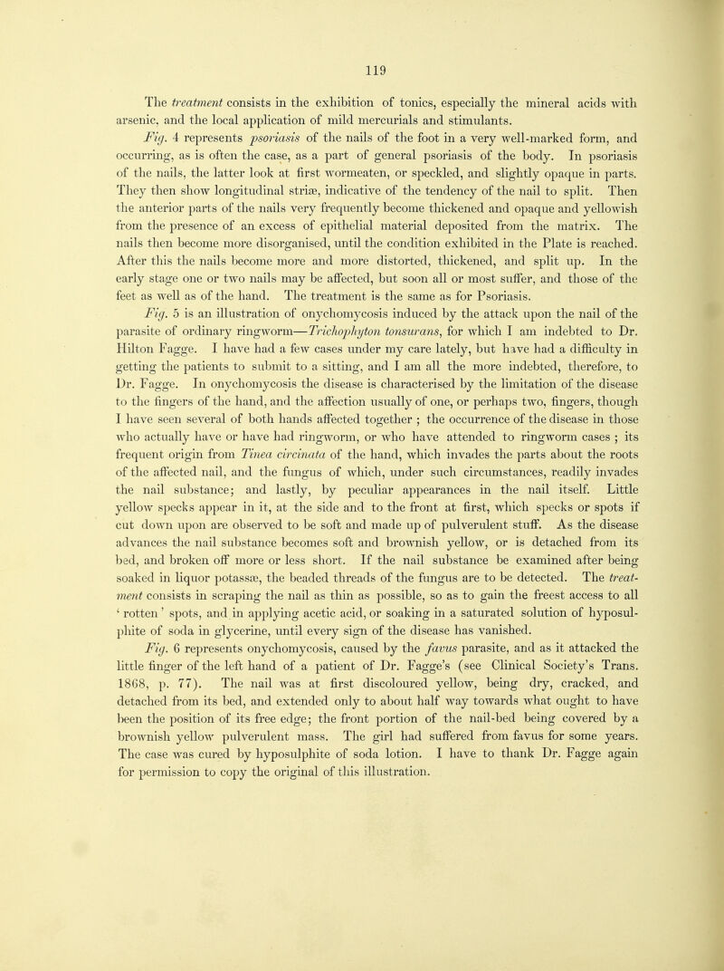 The treatment consists in the exhibition of tonics, especially the mineral acids with arsenic, and the local application of mild mercurials and stimulants. Fig. 4 represents psoriasis of the nails of the foot in a very well-marked form, and occurrmg, as is often the case, as a part of general psoriasis of the body. In psoriasis of the nails, the latter look at first wormeaten, or speckled, and slightly opaque in parts. They then show longitudinal strise, indicative of the tendency of the nail to split. Then the anterior parts of the nails very frequently become thickened and opaque and yellowish from the presence of an excess of epithelial material deposited from the matrix. The nails then become more disorganised, until the condition exhibited in the Plate is reached. After this the nails become more and more distorted, thickened, and split up. In the early stage one or two nails may be atfected, but soon all or most suffer, and those of the feet as well as of the hand. The treatment is the same as for Psoriasis. Fig. 5 is an illustration of onychomycosis induced by the attack upon the nail of the parasite of ordinary ringworm—Trichophyton tonsurans, for which I am indebted to Dr. Hilton Fagge. I have had a few cases under my care lately, but have had a difficulty in getting the patients to submit to a sitting, and I am all the more mdebted, therefore, to Dr. Fagge. In onychomycosis the disease is characterised by the limitation of the disease to the fingers of the hand, and the afifection usually of one, or perhaps two, fingers, though I have seen several of both hands afifected together ; the occurrence of the disease in those who actually have or have had ringworm, or who have attended to ringworm cases ; its frequent origin from Tinea circinata of the hand, which invades the parts about the roots of the affected nail, and the fungus of which, under such circumstances, readily invades the naU substance; and lastly, by peculiar appearances in the nail itself. Little yellow specks appear in it, at the side and to the front at first, which specks or spots if cut down upon are observed to be soft and made up of pulverulent stufi'. As the disease advances the nail substance becomes soft and brownish yellow, or is detached from its bed, and broken off more or less short. If the nail substance be examined after being soaked in liquor potassEe, the beaded threads of the fungus are to be detected. The treat- ment consists in scraping the nail as thin as possible, so as to gain the freest access to all ' rotten' spots, and in applying acetic acid, or soaking in a saturated solution of hyposul- phite of soda in glycerine, until every sign of the disease has vanished. Fig. 6 represents onychomycosis, caused by the favus parasite, and as it attacked the little finger of the left hand of a patient of Dr. Fagge's (see Clinical Society's Trans. 1868, p. 77). The nail was at first discoloured yellow, being dry, cracked, and detached from its bed, and extended only to about half way towards what ought to have been the position of its free edge; the front portion of the nail-bed being covered by a brownish yellow pulverulent mass. The girl had sufifered from favus for some years. The case was cured by hyposulphite of soda lotion. I have to thank Dr. Fagge again for permission to copy the original of this illustration.