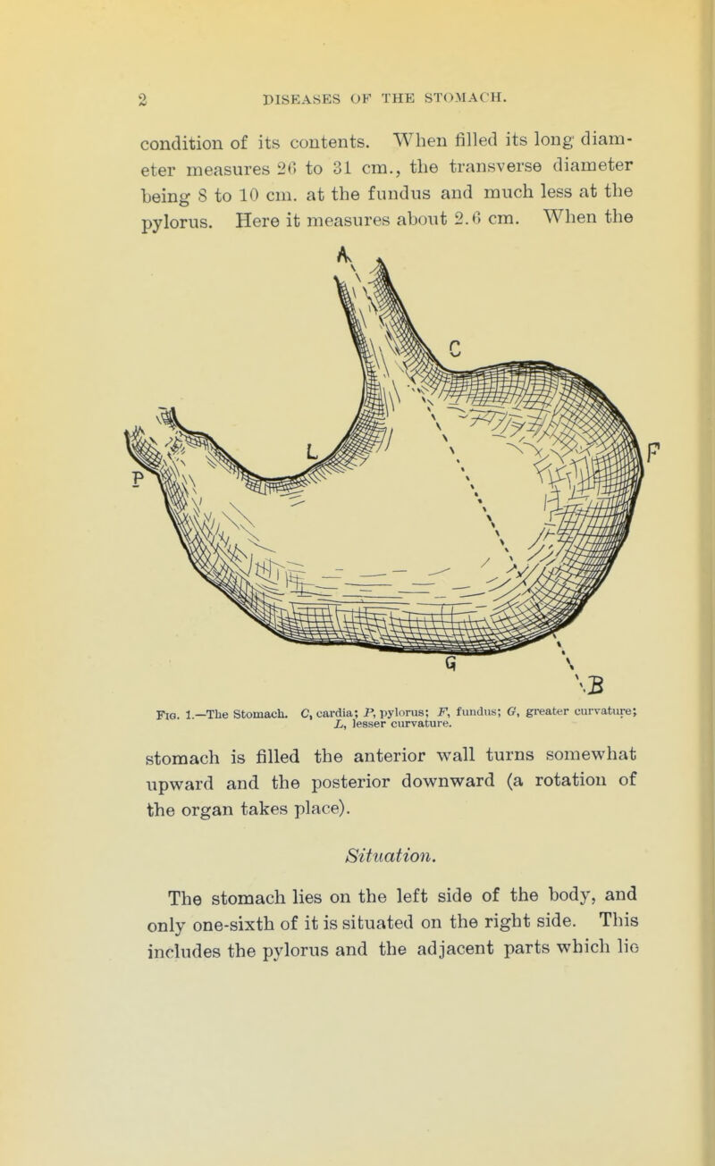 condition of its contents. When filled its long diam- eter measures 20 to 31 cm., the transverse diameter being S to 10 cm. at the fundus and much less at the pylorus. Here it measures about 2.6 cm. When the Fig. 1.—The Stomach. C, cardia; P, pylorus; F, fundus; G, greater curvature; L, lesser curvature. stomach is filled the anterior wall turns somewhat upward and the posterior downward (a rotation of the organ takes place). Situation. The stomach lies on the left side of the body, and only one-sixth of it is situated on the right side. This includes the pylorus and the adjacent parts which lie