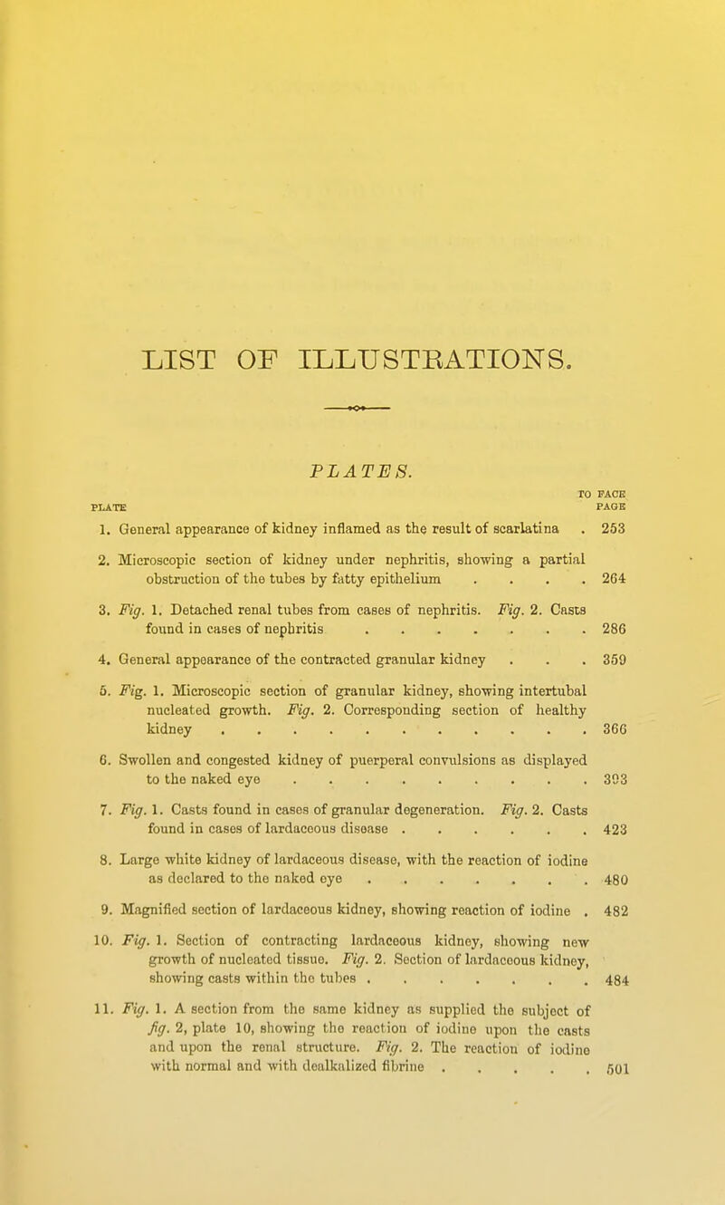 LIST OF ILLUSTRATIONS. PLATES. TO PACE PLATE PAOK 1. General appearance of kidney inflamed as the result of scarlatina . 253 2. Microscopic section of kidney under nephritis, showing a partial obstruction of the tubes by fatty epithelium .... 264 3. Fig. 1. Detached renal tubes from cases of nephritis. Fig. 2. Casts found in cases of nephritis 286 4. General appearance of the contracted granular kidney . . . 359 5. Fig. 1. Microscopic section of granular kidney, shewing intertubal nucleated growth. Fig. 2. Corresponding section of healthy kidney 366 6. Swollen and congested kidney of puerperal convulsions as displayed to the naked eye 303 7. Fig. 1. Casts found in cases of granular degeneration. Fig. 2. Casts found in cases of lardacoous disease ...... 423 8. Large white kidney of lardaceous disease, with the reaction of iodine as declared to the naked eye 480 9. Magnified section of lardaceous kidney, showing reaction of iodine . 482 10. Fig. 1. Section of contracting lardaceous kidney, showing new growth of nucleated tissue. Fig. 2. Section of lardacoous kidney, showing casts within the tubes 484 11. Fig. 1. A section from the same kidney as supplied the subject of Jig. 2, plate 10, showing the reaction of iodine upon tlio casts and upon the renal striicture. Fig. 2. The reaction of iodine Nvith normal and with dealkalized fibrine 501