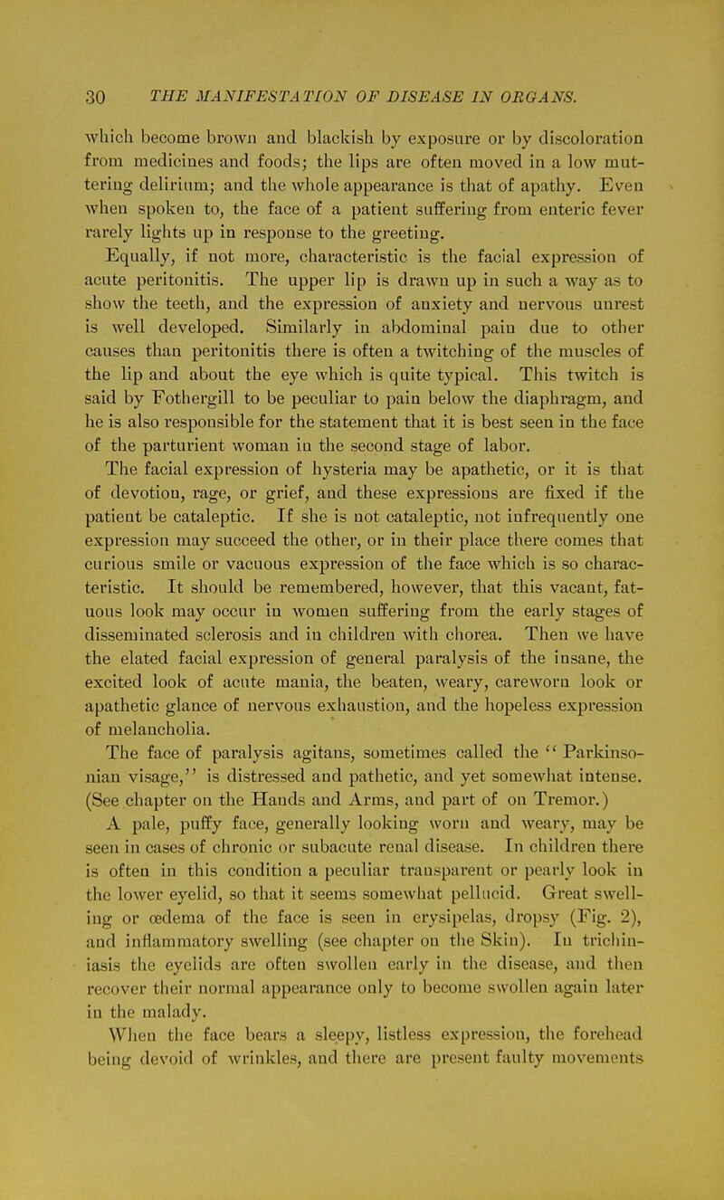 which become brown and blackish by exposure or by discoloration from medicines and foods; the lips are often moved in a low mut- tering delirium; and the whole appearance is that of apathy. Even when spoken to, the face of a patient suffering from enteric fever rarely lights up in response to the greeting. Equally, if not more, characteristic is the facial expression of acute peritonitis. The upper lip is drawn up in such a way as to show the teeth, and the expression of anxiety and nervous unrest is well developed. Similarly in abdominal pain due to other causes than peritonitis there is often a twitching of the muscles of the lip and about the eye which is quite typical. This twitch is said by Fothergill to be peculiar to pain below the diaphragm, and he is also responsible for the statement that it is best seen in the face of the parturient woman iu the second stage of labor. The facial expression of hysteria may be apathetic, or it is that of devotion, rage, or grief, and these expressions are fixed if the patieut be cataleptic. If she is not cataleptic, not infrequently one expression may succeed the other, or iu their place there comes that curious smile or vacuous expression of the face which is so charac- teristic. It should be remembered, however, that this vacant, fat- uous look may occur in women suffering from the early stages of disseminated sclerosis and in children with chorea. Then we have the elated facial expression of general paralysis of the insane, the excited look of acute mania, the beaten, weary, careworu look or apathetic glance of nervous exhaustion, and the hopeless expression of melancholia. The face of paralysis agitans, sometimes called the  Parkinso- nian visage, is distressed and pathetic, and yet somewliat intense. (See chapter on the Hands and Arms, and part of on Tremor.) A pale, puffy face, generally looking woru and weary, may be seen in cases of chronic or subacute renal disease. In children there is often in this condition a peculiar transparent or pearly look in the lower eyelid, so that it seems somewhat pellucid. Great swell- ing or oedema of the face is seen in erysipelas, dropsy (Fig. 2), and inflammatory swelling (see chapter on the Skin). In trichin- iasis the eyelids are often swollen early in the disease, and then recover their normal appearance only to become swollen again later in the malady. Wlien the face bears a sleepy, listless expression, the forehead being devoid of wrinkles, and there are present faulty movements