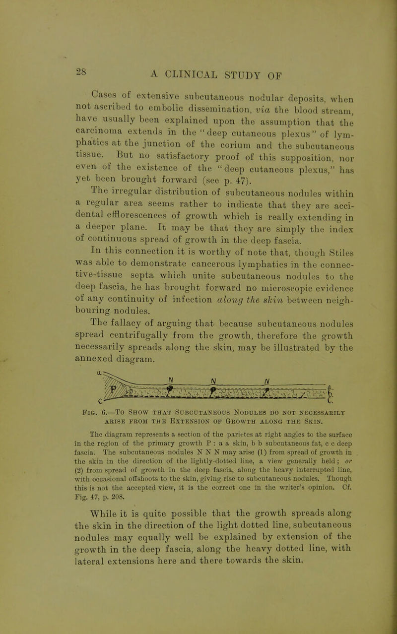 Cases of extensive subcutaneous nodular deposits, when not ascribed to embolic dissemination, via the blood stream, have usually been explained upon the assumption that the carcinoma extends in the deep cutaneous plexus of lym- phatics at the junction of the corium and the subcutaneous tissue. But no satisfactory proof of this supposition, nor even of the existence of the deep cutaneous plexus, has yet been brought forward (see p. 47). The irregular distribution of subcutaneous nodules within a regular area seems rather to indicate that they are acci- dental efflorescences of growth which is really extending in a deeper plane. It may be that they are simply the index of continuous spread of growth in the deep fascia. In this connection it is worthy of note that, though Stiles was able to demonstrate cancerous lymphatics in the connec- tive-tissue septa which unite subcutaneous nodules to the deep fascia, he has brought forward no microscopic evidence of any continuity of infection along the skin between neigh- bouring nodules. The fallacy of arguing that because subcutaneous nodules spread centrifugally from the growth, therefore the growth necessarily spreads along the skin, may be illustrated by the annexed diagram. JH N N c- c. Fig. 6.—To Show that Subcutaneous Nodules do not necessarily ARISE FROM THE EXTENSION OP GROWTH ALONG THE SKIN. The diagram represents a section of the parietes at right angles to the surface in the region of the primary growth P : a a skin, b b subcutaneous fat, c c deep fascia. The subcutaneous nodules NNN may arise (1) from spread of growth in the skin in the direction of the lightly-dotted line, a view generally held ; or (2) from spread of growth in the deep fascia, along the heavy interrupted line, with occasional offshoots to the skin, giving rise to subcutaneous nodules. Though this is not the accepted view, it is the correct one in the writer's opinion. Cf. Fig. 47, p. 208. While it is quite possible that the growth spreads along the skin in the direction of the light dotted line, subcutaneous nodules may equally well be explained by extension of the growth in the deep fascia, along the heavy dotted line, with lateral extensions here and there towards the skin.