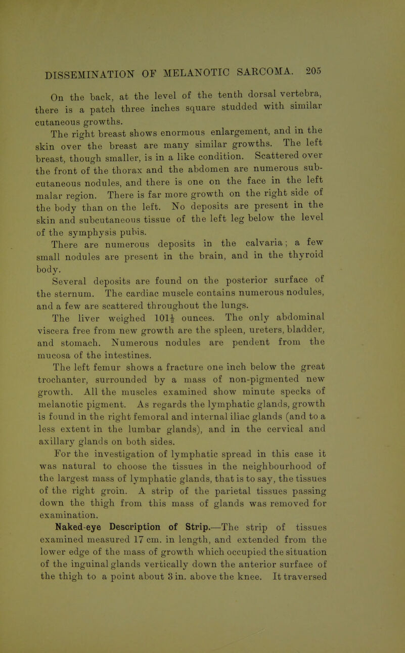 On the back, at the level of the tenth dorsal vertebra, there is a patch three inches square studded with similar cutaneous growths. The right breast shows enormous enlargement, and in the skin over the breast are many similar growths. The left breast, though smaller, is in a like condition. Scattered over the front of the thorax and the abdomen are numerous sub- cutaneous nodules, and there is one on the face in the left malar region. There is far more growth on the right side of the body than on the left. No deposits are present in the skin and subcutaneous tissue of the left leg below the level of the symphysis pubis. There are numerous deposits in the calvaria; a few small nodules are present in the brain, and in the thyroid body. Several deposits are found on the posterior surface of the sternum. The cardiac muscle contains numerous nodules, and a few are scattered throughout the lungs. The liver weighed 101£ ounces. The only abdominal viscera free from new growth are the spleen, ureters, bladder, and stomach. Numerous nodules are pendent from the mucosa of the intestines. The left femur shows a fracture one inch below the great trochanter, surrounded by a mass of non-pigmented new growth. All the muscles examined show minute specks of melanotic pigment. As regards the lymphatic glands, growth is found in the right femoral and internal iliac glands (and to a less extent in the lumbar glands), and in the cervical and axillary glands on both sides. For the investigation of lymphatic spread in this case it was natural to choose the tissues in the neighbourhood of the largest mass of lymphatic glands, that is to say, the tissues of the right groin. A strip of the parietal tissues passing down the thigh from this mass of glands was removed for examination. Naked-eye Description of Strip.—The strip of tissues examined measured 17 cm. in length, and extended from the lower edge of the mass of growth which occupied the situation of the inguinal glands vertically down the anterior surface of the thigh to a point about 3 in. above the knee. It traversed