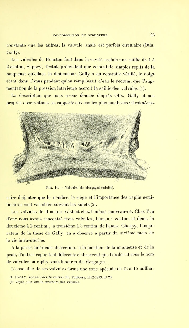 constante que les autres, la valvule anale est parfois circulaire (Otis, Gally). Les valvules de Houston font dans la cavité rectale une saillie de 1 à 2 centim. Sappey, Testut, prétendent que ce sont de simples replis de la muqueuse qu'etîace la distension; Gally a au contraire vérifié, le doigt étant dans l'anus pendant qu'on remplissait d'eau le rectum, que l'aug- mentation de la pression intérieure accroît la saillie des valvules (1). La description que nous avons donnée d'après Otis, Gally et nos propres observations, se rapporte aux cas les plus nombreux ; il est néces- Fifi. 14. — Valvules de Morgagni (adulte). saire d'ajouter que le nombre, le siège et l'importance des replis semi- lunaires sont variables suivant les sujets (2). Les valvules de Houston existent chez l'enfant nouveau-né. Chez l'un d'eux nous avons rencontré trois valvules, l'une à 1 centim. et demi, la deuxième à 2 centim., la troisième à 3 centim. de l'anus. Charpy, l'inspi- rateur de la thèse de Gally, en a observé à partir du sixième mois de la vie intra-utérine. A la partie inférieure du rectum, à la jonction de la muqueuse et de la peau, d'autres replis tout différents s'observent que l'on décrit sous le nom de valvules ou replis semi-lunaires de Morgagni. L'ensemble de ces valvules forme une zone spéciale de 12 à 15 millim. (1) Gally. Les valvules du rectum. Th. Toulouse, 1892-1893, n° 20. (2) Voyez plus loin la structure des valvules.