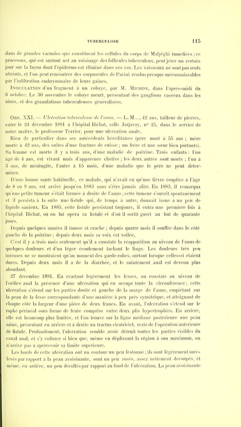 dans (lo gramlos vacuoles que constituent les cellules du corps de Malpighi tuméliées ; ce processus, qui est surtout net au voisinage des follicules tuberculeux, peutjeler un certain jour sur la fa(;on dont Fépidermeest éliminé dans ces cas. Les vaisseaux ne sont pas seuls atteints, et l'on peut rencontrer des corpuscules doPacini rendus presqiu' nn'connaissables par l'inliltration endjryonnaire de leurs gaines. Inoculation d'un fragment à un cobaye, par M. Michon, dans l'après-midi du 6 oclobre. Le 30 novembre le cobaye meurt, présentant des ganglions caséeux dans les aines, et des granulations tuberculeuses généralisées. Obs. XXI. — Ulcération tuhercuIcK^e de. l'anus. — L. M..., 42 ans, tailleur de pierres, cnire le 24 décembre 1891 à l'hôpital Bichat, salle Jarjavay, n 25, dans le service de noire maître, le professeur Terrier, pour une ulcération anale. Rien de particulier dans ses antécédents liéréditaires (père mort à 55 ans ; mère morte à 42 ans, des suites d'une fracture de cuisse ; un frère et une sœur bien portants). Sa femme est morte il y a trois ans, d'une maladie de poili-ine. Trois enfants : l'un tàgé de 4 ans, est vivant mais d'apparence cliétive ; les deux autres sont morts ; l'un à 3 ans, de méningite, l'autre à 15 mois, d'une maladie que le père ne peut déter- miner. D'une bonne santé habituelle, ce malade, qui n'avait eu qu'une fièvre éruptive à l'âge de 8 ou 9 ans, est arrivé jusqu'en 1883 sans s'être jamais alité. En 1883, il remarqua ipruue pelile tumeur s'était formée à droite de l'anus ; cette tumeur s'ouvrit spontanément et il persista à la suite une fistule qui, de tenq>s à autre, donnait issue à un peu de li(iaide sanieux. En 1885, cette fistule persistant toujours, il entra une première fois à l'hôpital Bichat, où on lui opéra sa fistule et d'où il sortit guéri au Init d(3 quarante jours. Depuis (|uelques années il tousse et crache ; depuis quatre mois il souffre dans le côté gauche de la poitrine ; depuis deux mois sa voix est voilée. C'est il y a trois mois seulement qu'il a constaté la réapparition au niveau de l'anus de quelques douleurs et d'un léger écoulement tachant le linge. Les douleurs très peu intenses ne se montraient qu'au moment des garde-robes, surtout lorsque celles-ci étaient dures. Depuis deux mois il a de la diarrhée, et le suintement anal est devenu plus al)ondant. 27 décembre 1891. En écartant légèrement les fesses, on constate au niveau de l'orifice anal la présence d'une ulcération qui en occupe toute la circonférence ; cette ulcération s'étend sur les parties droite et gauche de la marge de l'anus, empiétant sur la peau de la fesse correspondante d'une manière à peu près symétrique, et atteignant de chaque côté la largeur d'une pièce de deux francs. En avant, l'ulcération s'étend sur le raphé périnéal sous forme de fente comprise entre deux plis hypertrophiés. En arrière, elle est beaucoup plus limitée, et l'on trouve sur la ligne médiane postérieure une peau saine, présentant en arrière et à droite un tractus cicatriciel, reste de l'opération antérieure de fistule. Profondément, l'ulcération semble avoir détruit toutes les parties visibles du canal anal, et s'y enfonce si bien que, même en déplissant la région à son maxinumi, on n'arrive i)as à apercevoir sa limite supérieure. Les bords de cette ulcération ont un contour un peu festonné ; ils sont légèrement siu'è- levés par rapport à la peau avoisinante, sont un peu rosés, assez nettement découpés, et même, en arrière, un peu décollés par rapport au fond de l'ulcération. La peau avoisinante