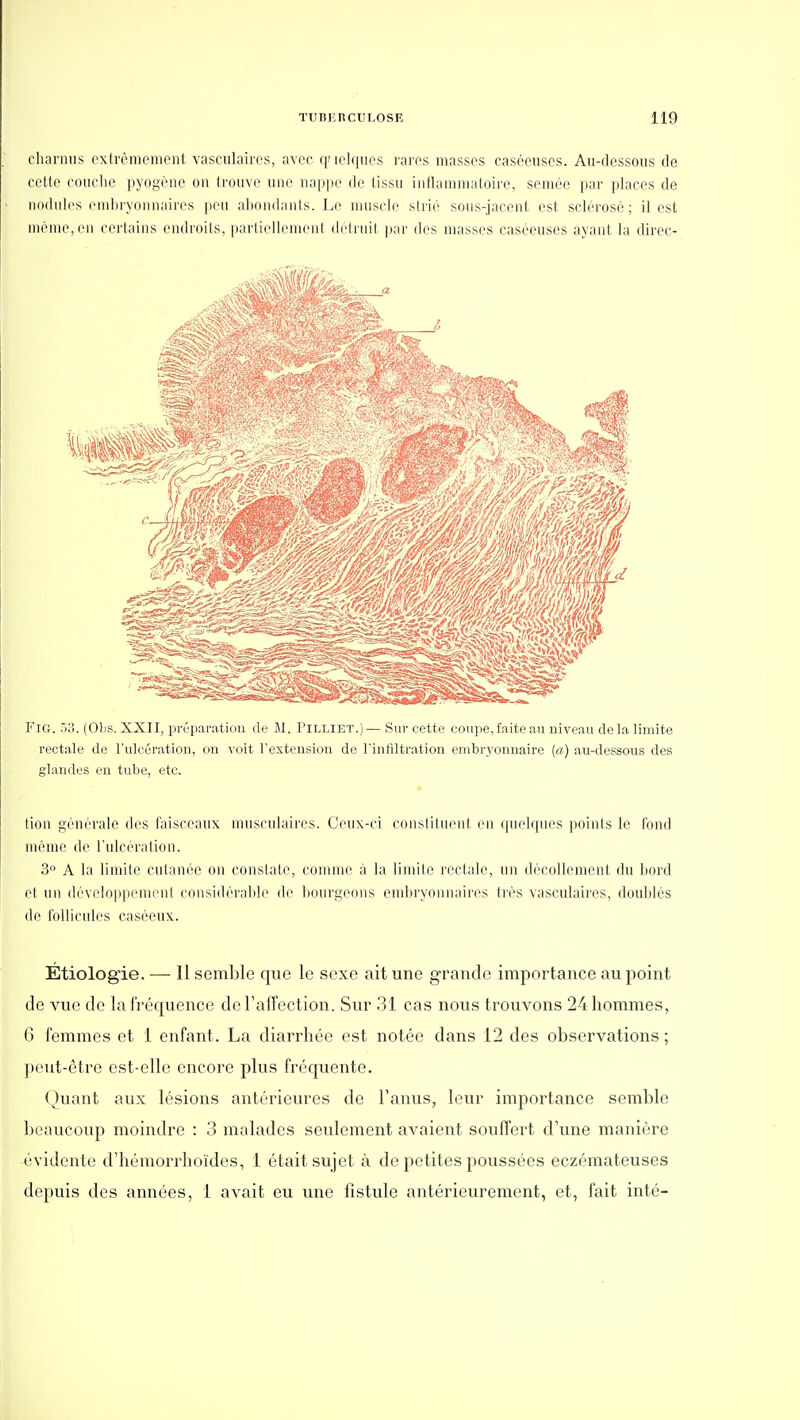 charnus cxtrèmomenl vasculaires, avec q' lelqiios rares masses caséciises. Au-dessous de cette couche pyogène on trouve une nappe de tissu inflammatoire, semée par places de nodules embryonnaires peu abondants. Le nuiscle sirié sous-jacent est sclérosé ; il est même,en certains endroits, parliellenieni dclrnit pai' des masses caséeuses ayant la direc- FiG. .jI). (Olis. XXII, préparation de M. Pilliet.) — Sur cette coupe,faite au niveau de la limite rectale de l'ulcération, on voit festeiision de l'infiltration embryonnaire (a) au-dessous des glandes eu tube, etc. * fion générale des faisceaux musculaires. Ceux-ci constituent en qucbpies points le fond même de l'ulcération. 3° A la limite cutanée on conslale, comme à la limite rectale, un décollement du bord et un développement considérable de bourgeons emln-yonnaires très vasculaires, doublés de follicnles caséeux. Étiologie. — 11 semble que le sexe ait une grande importance au point de vue de lai'récjuence del'alFection. Sur 31 cas nous trouvons 24 hommes, G femmes et 1 enfant. La diarrhée est notée dans 12 des observations ; ])('ut-6tre est-elle encore plus fréquente. ()uant aux lésions antérieures de l'anus, leur importance semble ])eaucoup moindre : 3 malades seulement avaient souffert d'une manière évidente d'hémorrhoïdes, 1 était sujet à de petites poussées eczémateuses depuis des années, i avait eu une fistule antérieurement, et, fait inté-