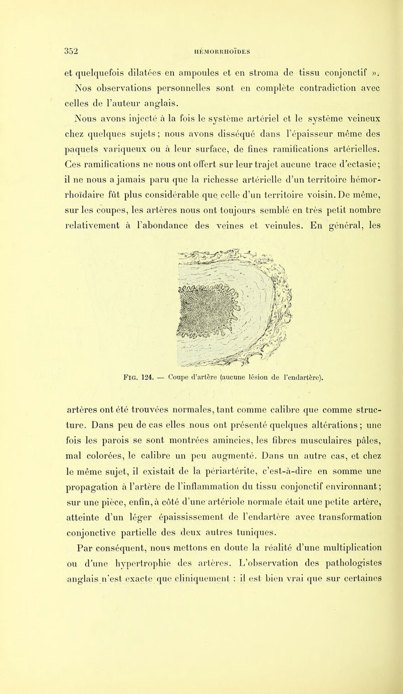 et quelquefois dilatées en ampoules et en stroma de tissu conjonctif ». Nos observations personnelles sont en complète contradiction avec celles de l'auteur anglais. Nous avons injecté à la fois le système artériel et le système veineux chez quelques sujets; nous avons disséqué dans l'épaisseur même des paquets variqueux ou à leur surface, de fines ramifications artérielles. Ces ramifications ne nous ont offert sur leur trajet aucune trace d'ectasie; il ne nous a jamais paru que la richesse artérielle d'un territoire hémor- rhoïdaire fût plus considérable que celle d'un territoire voisin. De même, sur les coupes, les artères nous ont toujours semblé en très petit nombre relativement à l'abondance des veines et veinules. En général, les FiG. 124. — Coupe d'artère (aucune lésion de l'endartère). artères ont été trouvées normales, tant comme calibre que comme struc- ture. Dans peu de cas elles nous ont présenté quelques altérations; une fois les parois se sont montrées amincies, les fibres musculaires pâles, mal colorées, le calibre un peu augmenté. Dans un autre cas, et chez le même sujet, il existait de la périartérite, c'est-à-dire en somme une propagation à l'artère de l'inflammation du tissu conjonctif environnant; sur une pièce, enfin, à côté d'une artériole normale était une petite artère, atteinte d'un léger épaississement de l'endartère avec transformation conjonctive partielle des deux autres tuniques. Par conséquent, nous mettons en doute la réalité d'une multiplication ou d\me h^^pertrophie des artères. L'observation des pathologistes anglais n'est exacte que cliniquement : il est bien vrai que sur certaine^