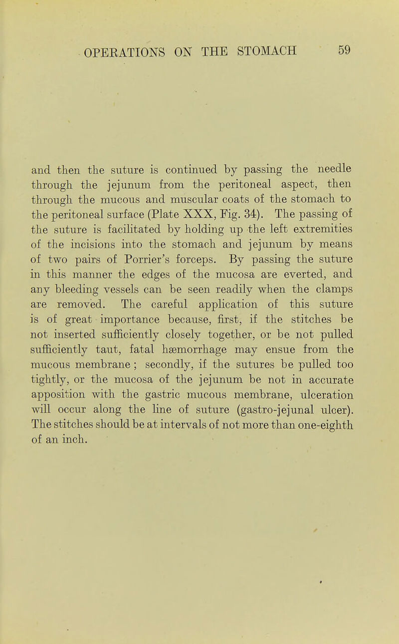 and then the suture is continued by passing the needle through the jejunum from the peritoneal aspect, then through the mucous and muscular coats of the stomach to the peritoneal surface (Plate XXX, Fig. 34). The passing of the suture is facilitated by holding up the left extremities of the incisions into the stomach and jejunum by means of two pairs of Porrier's forceps. By passing the suture in this manner the edges of the mucosa are everted, and any bleeding vessels can be seen readily when the clamps are removed. The careful application of this suture is of great importance because, first, if the stitches be not inserted sufficiently closely together, or be not pulled sufficiently taut, fatal haemorrhage may ensue from the mucous membrane; secondly, if the sutures be pulled too tightly, or the mucosa of the jejunum be not in accurate apposition with the gastric mucous membrane, ulceration will occur along the line of suture (gastro-jejunal ulcer). The stitches should be at intervals of not more than one-eighth of an inch. *