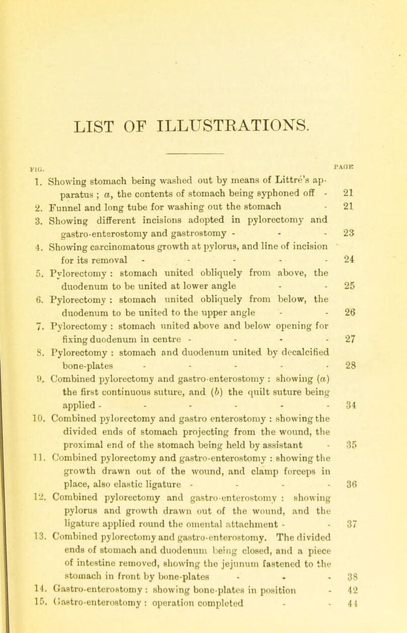 LIST OF ILLUSTEATIONS. 1. Showing stomach being washed out by means of Littre's ap- paratus ; o, the contents of stomach being syphoned off - 21 2. Funnel and long tube for washing out the stomach - 21 3. Showing different incisions adopted in pylorectomy and gastro-enterostomy and gastrostomy - - - 23 4. Showing carcinomatous growth at pylorus, and line of incision for its removal - - - - - 24 5. Pylorectomy : stomach united obliquely from above, the duodenum to be united at lower angle - - 25 6. Pylorectomy : stomach united obliquely from below, the duodenum to be united to the upper angle - - 26 7. Pylorectomy : stomach imited above and below opening for fixing duodenum in centre - - • - 27 8. Pylorectomy : stomach and duodenum united by decalcified bone-plates - - - - - 28 9. Combined pylorectomy and gastro-enterostomy : showing (a) the first continuous suture, and (b) the quilt suture being applied - - - - - - 34 10. Combined pylorectomy and gastro enterostomy : showing the divided ends of stomach projecting from the wound, the proximal end of the stomach being held by assistant - 35 11. Combined pylorectomy and gastro-enterostomy : showing the growth drawn out of the wound, and clamp forceps in place, also elastic ligature - - - - 36 1-!. Combined pylorectomy and gastro enterostomy : showing pylorus and growth drawn out of the wound, and the ligature applied round the omental attachment - • 37 13. Combined pylorectomy and gastro-enterostomy. The divided ends of stomach and duodenum being closed, and a piece of intestine removed, showing the jejunum fastened to the stomach in front by b(me-plates - . - 38 14. Gastro-enterostomy: showing bone-plates in position - 42 If). (Jastro-enterostomy: operation completed - - 44