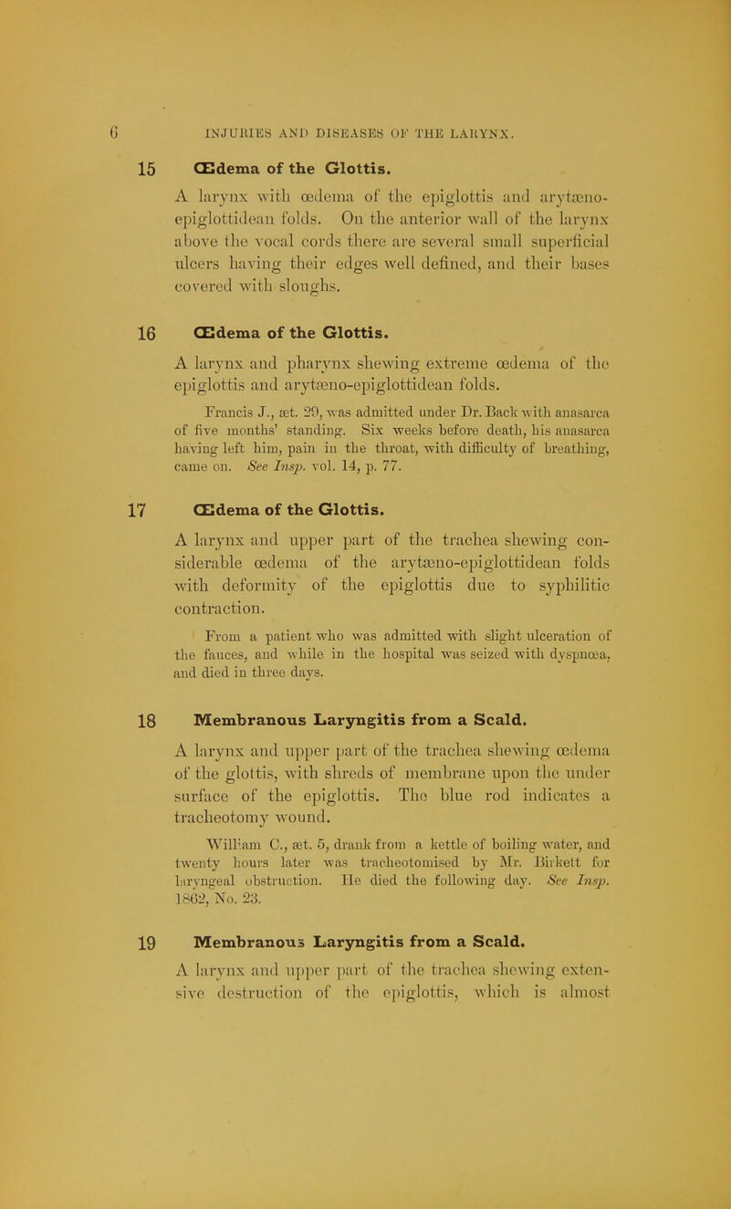 CEdema of the Glottis. A larynx with oedema of the epiglottis and arytteno- epiglottidean folds. On the anterior wall of the larynx- above the vocal cords there are several small superficial ulcers having their edges well defined, and their bases covered with sloughs. CBdema of the Glottis. A larynx and pharynx shewing extreme oedema of the epiglottis and arytseno-epiglottidean folds. Francis J., aet. 29, -was admitted under Dr. Back with anasarca of five months' standing'. Six weeks before death, his anasarca having left him, pain in the throat, with difficulty of breathing, came on. See Insp. vol. 14, p. 77. CUdema of the Glottis. A larynx and upper part of the trachea shewing con- siderable oedema of the arytasno-epiglottidean folds with deformity of the epiglottis due to syphilitic contraction. From a patient who was admitted with slight ulceration of the fauces, and hile in the hospital was seized with dyspnoea, and died in three days. Membranous Laryngitis from a Scald. A larynx and upper part of the trachea shewing oedema of the glottis, with shreds of membrane upon the under surface of the epiglottis. The blue rod indicates a tracheotomy wound. William C, £et. 5, drank from a kettle of boiling water, and twenty hours later was tracheotomised by Mr. Birkett for laryngeal obstruction. He died the following day. See Insp. No. 23. Membranous Laryngitis from a Scald. A larynx and upper ynwi of the trachea shewing exten- sive destruction of the epiglottis, which is almost