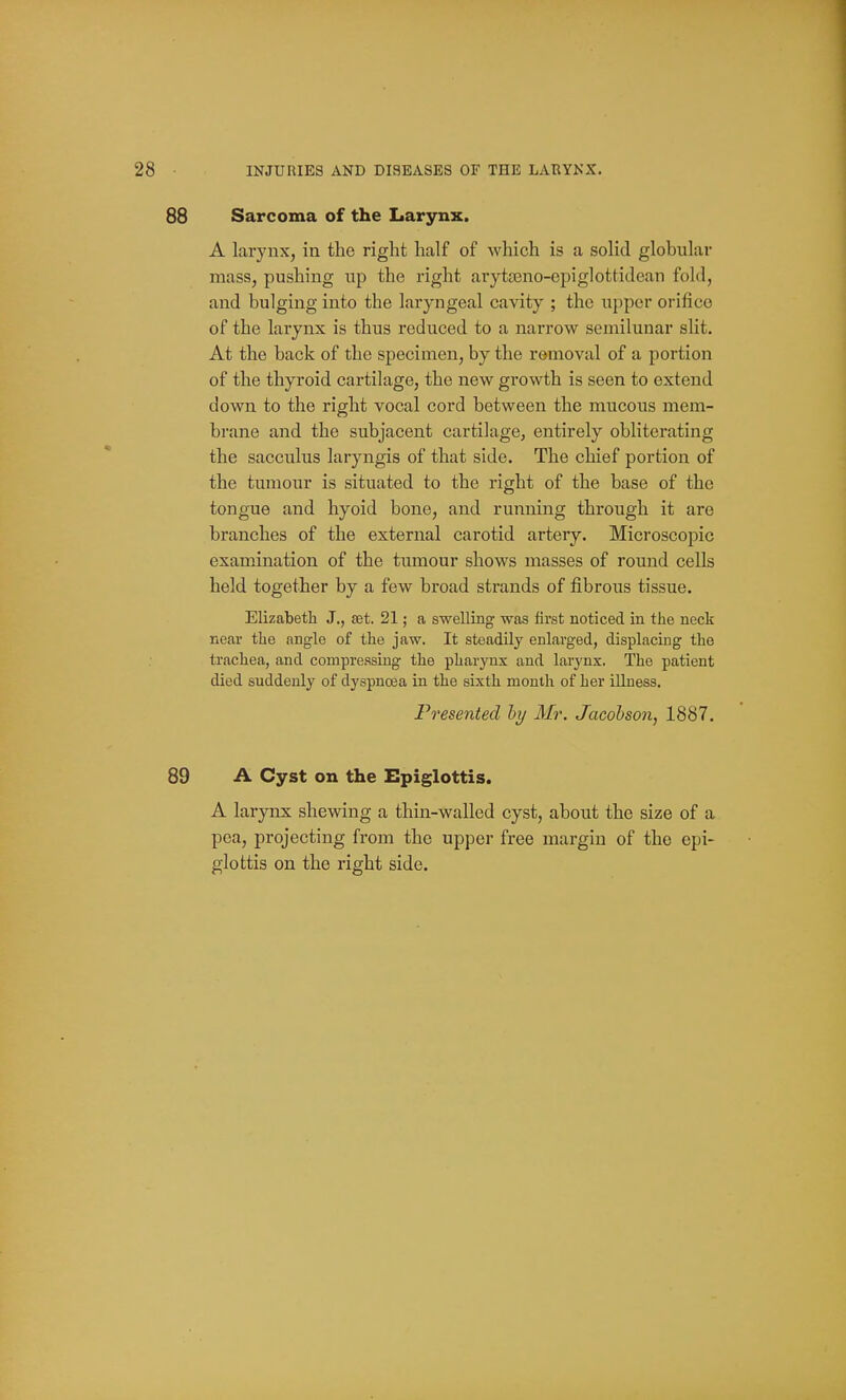 88 Sarcoma of the Larynx. A larynx, in the right half of which is a solid globular mass, pushing up the right arytjeno-epiglottidean fold, and bulging into the laryngeal cavity ; the upper orifice of the larynx is thus reduced to a narrow semilunar slit. At the back of the specimen, by the removal of a portion of the thyroid cartilage, the new growth is seen to extend down to the right vocal cord between the raucous mem- brane and the subjacent cartilage, entirely obliterating the sacculus laryngis of that side. The chief portion of the tumour is situated to the right of the base of the tongue and hyoid bone, and running through it are branches of the external carotid artery. Microscopic examination of the tumour shows masses of round cells held together by a few broad strands of fibrous tissue. Elizabeth J., set. 21; a swelling was first noticed in the neck near the angle of the jaw. It steadily enlarged, displacing the trachea, and compreasiug the pharynx and larynx. The patient died suddenly of dyspnoea in the sixth month of her illness. Presented hy Mr. Jacohson, 1887. 89 A Cyst on the Epiglottis. A larynx shewing a thin-walled cyst, about the size of a pea, projecting from the upper free margin of the epi- glottis on the right side.
