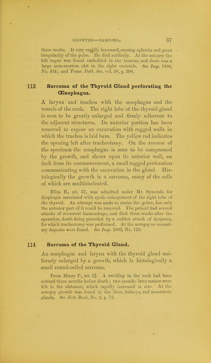 tlirco -weelcs. It very rapj.clly increased, causing aphonia and great irregularity of the pulse. lie died suddenly. At the autop.sy tlio left vagus was found embedded in the tumour, and there was a largo ante-mortem clot in tlie right ventricle. See 'Insp. 1886, No. 434; and Tram. Vath. Soc. vol. 38, p. 398. Sarcoma of the Thyroid Gland perforating the oesophagus. A lai'ynx and trachea vsitli the oesophagus and the vessels of the neck. The right lobe of the thyroid gland is seen to be greatly enlarged and linnly adherent to the adjacent structures. Its anterior portion has been removed to expose an excavation with ragged walls in which the trachea is laid bare. The yellow rod indicates the opening left after tracheotomy. On the reverse of the specimen the oesophagus is seen to be compressed by the growth, and shews upon its anterior wall, an inch from its commencement, a small ragged perforation communicating with the excavation in the gland. His- tologically the growth is a sarcoma, many of the cells of which are multinucleated. Eliza B., £et. 57, was admitted under Mr. Symonds for dysphagia associated with cystic enlargement of the right lobe of the thyroid. An attempt was made to excise the goitre, but only the anterior part of it could be removed. The i)atient had several attacks of recurrent hsemorrhage, and died three weeks after the operation, death being preceded by a sudden attack of dyspnoia, for which tracheotomy was performed. At the autopsy no second- ary deposits were found. See Insp. 1892, No. 123. Sarcoma of the Thyroid Gland. An oesophagus and larynx with the thyroid gland uni- formly enlarged by a grovvth, which is histologically a small round-celled sarcoma. From Henry P., vet. 3:^. A swelling in tho nock had been noticed three months before death ; two month.s later masses were felt in the abdomen, which rapidly increased in size. At the autopsy growth was found in tho liver, kidneys, and mesenteric glands. See Note Hunk, No. 2, ]). 73.