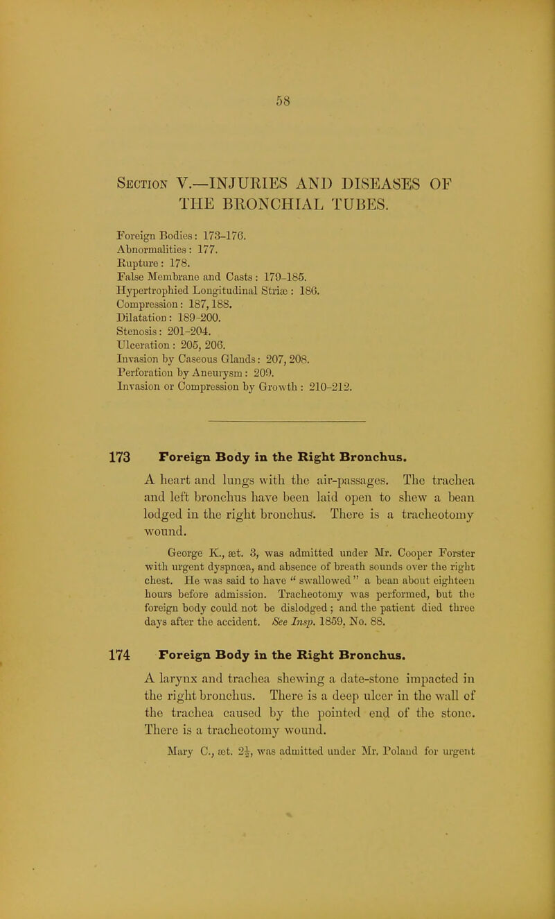 Section V.—INJURIES AND DISEASES OF THE BEONCHIAL TUBES. Foreign Bodies: 173-176. Abnormalities: 177. Rupture: 178. False Membrane and Casts : 179-185. Hypertrophied Longitudinal Stria3: 186. Compression: 187,188. Dilatation: 189-200. Stenosis: 201-204. Ulceration: 205, 206. Invasion by Caseous Glands: 207, 208. Perforation by Aneurysm: 209. Invasion or Compression by Growth : 210-212. 173 Foreign Body in the Right Bronchus. A heart and lungs with the air-passages. The trachea and left bronchus have been laid open to shew a bean lodged in the right bronchus. There is a tracheotomy wound. George K., aet. 3, was admitted under Mr. Cooper Forster ■with urgent dyspnoea, and absence of breath sounds over the right chest. He was said to have  swallowed  a bean about eighteen hours before admission. Tracheotomy was performed, but the foreign body could not be dislodged ; and the patient died three days after the accident. See Insp. 1859. No. 88. 174 Foreign Body in the Right Bronchus. A larynx and trachea shewing a date-stone impacted in the right bronchus. There is a deep ulcer in the wall of the trachea caused by the pointed end of the stone. There is a tracheotomy wound. Mary C, a3t. 2^, was admitted under Mr. Poland for urgent