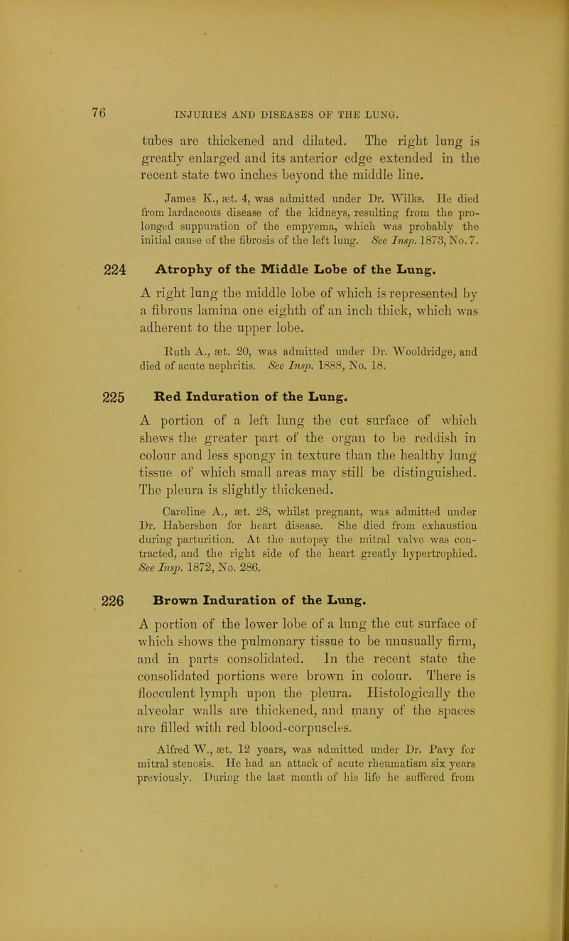tubes are thickened and dilated. The right lung is greatly enlarged and its anterior edge extended in the recent state two inches beyond the middle line. James K., aet. 4, was admitted under Dr. Wilks. He died from lardaceous disease of the kidneys, resulting from the pro- longed suppuration of the empyema, which was probably the initial cause of the fibrosis of the left lung. See Insp. 1873, Iso. 7. 224 Atrophy of the Middle Lobe of the Lung. A right lung the middle lobe of which is represented by a fibrous lamina one eighth of an inch thick, which was adherent to the upper lobe. Ruth A., aet. 20, was admitted under Dr. Wooldridge, and died of acute nephritis. See Insj). 1888, No. 18, 225 Red Induration of the Lung. A portion of a left lung the cut surface of which shews the greater part of the organ to be reddish in colour and less spongy in texture than the healthy lung tissue of which small areas may still be distinguished. The pleura is slightly thickened. Caroline A., set. 28, whilst pregnant, was admitted under Dr. Habershon for heart disease. She died from exhaustion during parturition. At the autopsy the mitral valve was con- tracted, and the right side of the heart greatly hypertrophied. See Insp. 1872, No. 286, 226 Brown Induration of the Lung. A portion of the lower lobe of a lung the cut surface of which shows the pulmonary tissue to be unusually firm, and in parts consolidated. In the recent state the consolidated portions were brown in colour. There is flocculent lymph upon the pleura. Histologically the alveolar walls are thickened, and many of the spaces are filled with red blood-corpi;scles. Alfred W., jet. 12 years, was admitted under Dr. Pavy for mitral stenosis. He had an attack of acute rheumatism six years previously. During the last month of his life he suflercd from