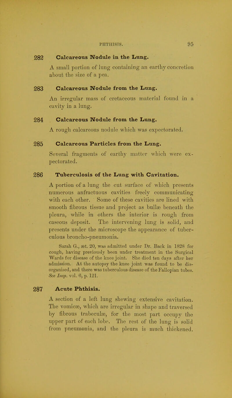 282 Calcareous Nodule in the Lung. A small portion of lung containing an earthy concretion about tlie size of a pea. 283 Calcareous Nodule from the Lung. An irregular mass of cretaceous material found in a cavity in a lung. 284 Calcareous Nodule from the Lung. A rough calcareous nodule which was expectorated. 285 Calcareous Particles from the Lung. Several fragments of earthy matter which were ex- pectorated. 286 Tuberculosis of the Lung with Cavitation. A portion of a lung the cut surface of which presents numerous anfractuous cavities freely communicating with each other. Some of these cavities are lined with smooth fibrous tissue and project as bullae beneath the pleura, while in others the interior is rough from caseous deposit. The intervening lung is solid, and presents under the microscope the appearance of tuber- culous broncho-pneumonia. Sarah G., set. 20, was admitted under Dr. Back in 1828 for cough, having previously been under treatment in the Surgical Wards for disease of the knee joint. She died ten days after her admission. At the autopsy the knee joint was found to be dis- organised, and there was tuberculous disease of the Fallopian tubes. See Insp. vol. 6, p. 121. 287 Acute Phthisis. A section of a left lung shewing extensive cavitation. The vomicae, which are irregular in shape and traversed by fibrous trabeculse, for the most part occupy the upper part of each lobe. The rest of the lung is solid from pneumonia, and the phnira is nmch thickened.