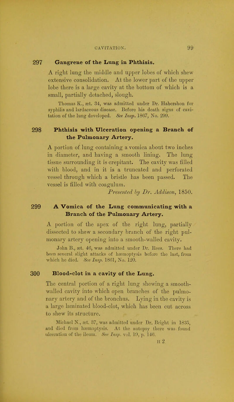 297 Gangrene of the Lung in Phthisis. A right lung the iniddlo and upper lobes of which shew extensive consolidation. At the lower part of the upper lobe there is a large cavity at the bottom of which is a small, partially detached, slough. Thomas K., set. 34, was admitted under Dr. Haberalion for syphilis and hxrdaceous disease. Before his death signs of cavi- tation of the lung developed. See Lisp. 1867, No. 299. 298 Phthisis with Ulceration opening a Branch of the Pulmonary Artery. A portion of. lung containing a vomica about two inches in diameter, and having a smooth lining. The lung tissue surrounding it is crepitant. The cavity was filled with blood, and in it is a truncated and perforated vessel through which a bristle has been passed. The vessel is filled with coagulum. Presented hy Dr. Addison, 1850. 299 A Vomica of the Lung communicating with a Branch of the Pulmonary Artery. A portion of the apex of the right lung, partially dissected to shew a secondary branch of the right pul- monary artery opening into a smooth-walled cavity. John B., set. 46, was admitted under Dr. Eees. There liad been several slight attacks of hsemoptysis before the last, from which he died. See Insp. 1861, No. 120. 300 Blood-clot in a cavity of the Lung. The central portion of a right lung shewing a smooth- walled cavity into which open branches of the pulmo- nary artery and of the bronchus. Lying in the cavity is a large laminated blood-clot, which has been cut across to shew its structure. Michael N., rat. .37, was admitted under Dr. Bright in IS-'i-'i, and died from htemoptysis. At the autopsy there was found ulceration of the ileum. See Li.yi. vol. It), p. 146. II 2