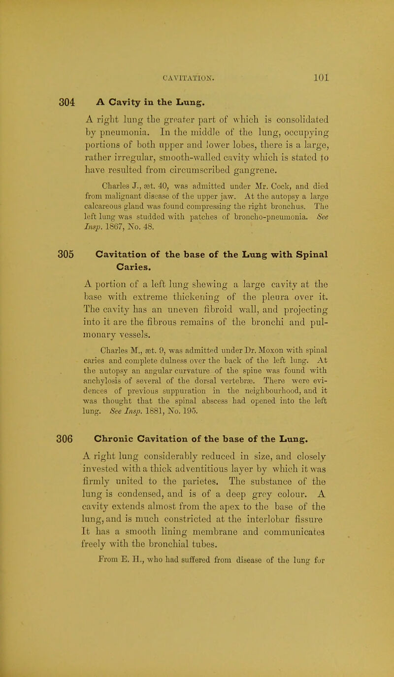 304 A Cavity in the Lung. A riglit lung tbe grnalcr part of whicli is consolidated by pneumonia. In the middle of the lung, occupying portions of both upper and lower lobes, there is a large, rather irregular, smooth-walled cavity which is stated to have resulted from circumscribed gangrene. Charles J., tet. 40, was admitted under Mr. Cock, and died from maliijnant disease of tlie upper jaw. At the autopsy a large calcareous glaud was found compressing the right bronchus. The left lung was studded with patches of broncho-pneumonia. See Imp. 1867, No. 48. 305 Cavitation of the base of the Lung with Spinal Caries. A portion of a left lung shewing a large cavity at the base with extreme thickening of the pleura over it. The cavity has an uneven fibroid wall, and projecting into it are the fibrous remains of the bronchi and pul- monary vessels. Charles M., set. 9, was admitted under Dr. Moxon with spinal caries and complete dulness over the back of the left lung. At the autopsy an angular curvature of the spine was found with anchylosis of several of the dorsal vertebras. There were evi- dences of previous suppiuation in the neighbourhood, and it was thought that the spinal abscess had opened into the left lung. See Insp. 1881, No. 195, 306 Chronic Cavitation of the base of the Lung. A right lung considerably reduced in size, and closely invested with a thick adventitious layer by which it was firmly united to the parietes. The substance of the lung is condensed, and is of a deep grey colour. A cavity extends almost from the apex to the base of the lung, and is much constricted at the interlobar fissui-e It has a smooth lining membrane and communicatea freely with the bronchial tubes. From E. II., who had suffered from disease of the lung for