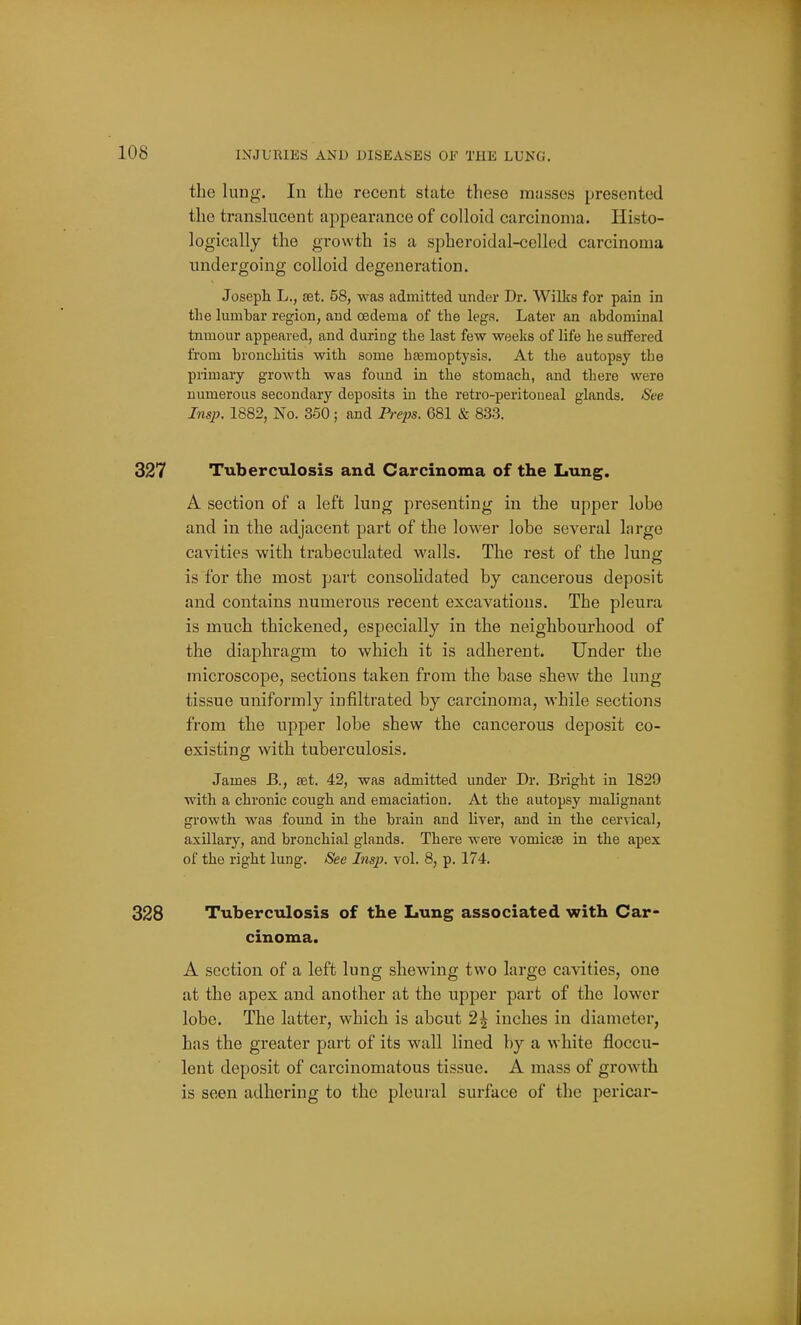 the lung. In the recent state these masses presented the translucent appearance of colloid carcinoma. Histo- logically the growth is a spheroidal-celled carcinoma undergoing colloid degeneration. Joseph L., set. 58, was admitted under Dr. Willcs for pain in the lumbar region, and oedema of the legs. Later an abdominal tnmour appeared, and during the last few weeks of life he suffered from bronchitis with some hsemoptysis. At the autopsy the primary growth was found in the stomach, and there were numerous secondary deposits in the retro-peritoueal glands, ^'e Insp. 1882, No. 350 ; and Preps. 681 & 833. 327 Tuberculosis and Carcinoma of the Lung. A section of a left lung presenting in the upper lobe and in the adjacent part of the lower lobe several large cavities with trabeculated walls. The rest of the lung is for the most part consoHdated by cancei'ous deposit and contains numerous recent excavations. The pleura is much thickened, especially in the neighbourhood of the diaphragm to which it is adherent. Under the microscope, sections taken from the base shew the lung tissue uniformly infiltrated by carcinoma, while sections from the upper lobe shew the cancerous deposit co- existing with tuberculosis. James B., set. 42, was admitted under Dr. Bright in 1829 with a chronic cough and emaciation. At the autopsy malignant growth was found in the brain and liver, and in the cervical, axillary, and bronchial glands. There were vomicae in the apex of the right lung. See Insp. vol. 8, p. 174. 328 Tuberculosis of the Lung associated with Car- cinoma. A section of a left lung shewing two large ca-sdties, one at the apex and another at the upper part of the lower lobe. The latter, which is about 2^ inches in diameter, has the greater part of its wall lined by a white floccu- lent deposit of carcinomatous tissue. A mass of growth is seen adhering to the pleural surface of the pericar-