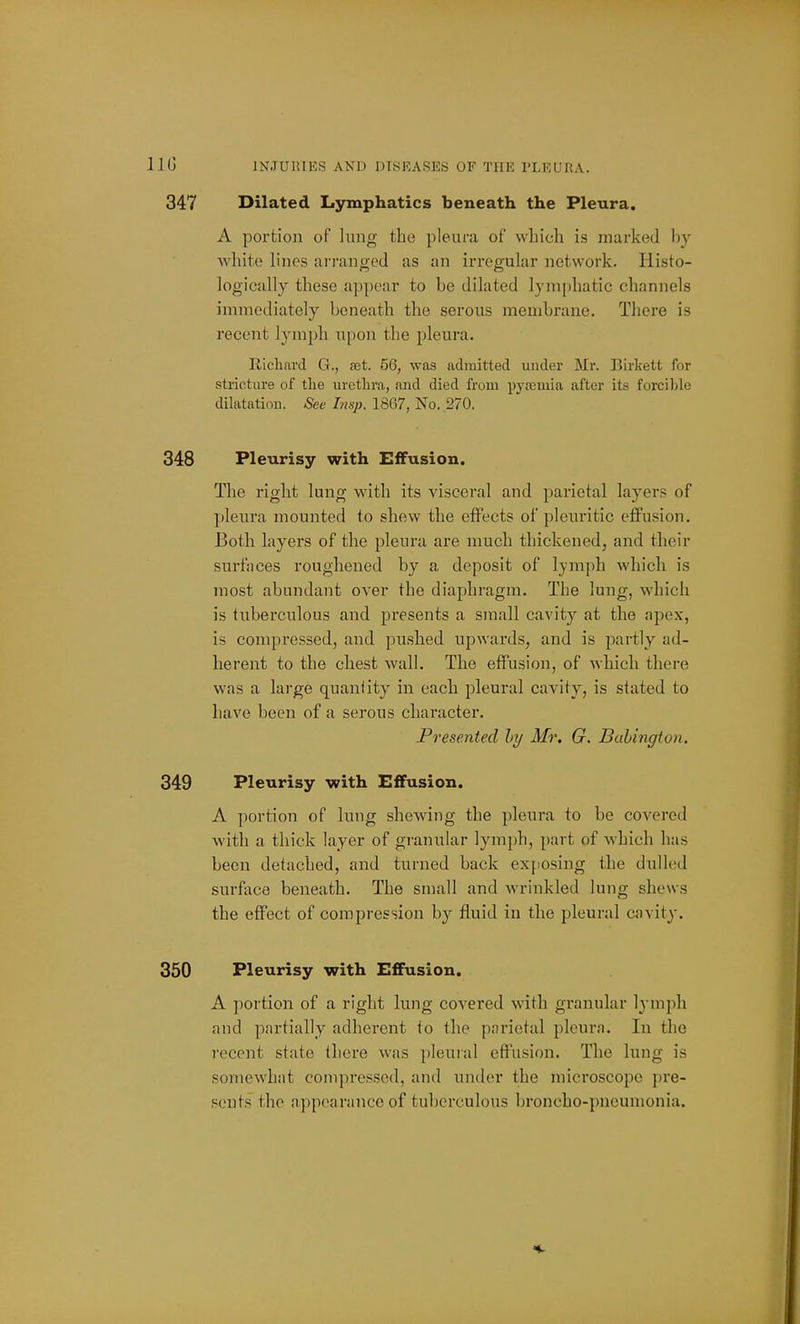 Dilated Lymphatics beneath the Pleura. A portion of lung the pleura of which is marked hy white lines arranged as an irregular network. Histo- logically these appear to be dilated lymphatic channels iinmediately beneath the serous membrane. Tliere is recent lymph upon the pleura. Richard G., aet. 56, was admitted under Mr. Birkett for stricture of the urethra, and died from pyoemia after its forcihlc dilatatiou. See Insp. 1867, No. .270. Pleurisy with Effusion. The right lung with its visceral and parietal layers of pleura mounted to shew the effects of pleuritic e£fu.sion. Both layers of the pleura are much thickened, and their surfaces roughened by a deposit of lymph which is most abundant over the diaphragm. The lung, which is tuberculous and presents a small cavity at the apex, is compressed, and pushed upwards, and is partly ad- herent to the chest wall. The effusion, of which there was a large quantity in each pleural cavity, is stated to have been of a serous character. Presented hy Mr, G. Buhingion. Pleurisy with Effusion. A portion of lung shewing the ])leura to be covered with a thick layer of granular lymph, part of which has been detached, and turned back exposing the dulled surface beneath. The small and wrinkled lung shews the effect of compression by fluid in the pleural cavity. Pleurisy with Effusion. A portion of a right lung covered with granular lymph and partially adherent to the parietal pleura. In the recent state there was pleural ef!\ision. The lung is somewhat compressed, and under the microscope pre- sents the n])poarance of tuberculous broncho-pneumonia.