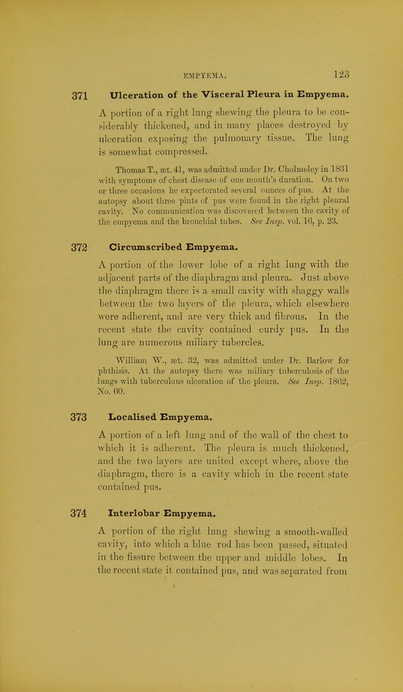 371 Ulceration of the Visceral Pleura in Empyema. A portion of a right lung shewing the pleura to be con- sltlerably thickened, and in many places destroycnl by ulceration exposing the })uhnonury tissue. The lung is somewhat compressed. Thomas T., ret. 41, was nclmiltatl under Dr. Cliohneley in 1831 with symptoms of cliest disease of one month's duration. On two or three occasions he expectorated several ounces of pus. At the autopsy about three pints of pus were found in tlie light pleural cavity. No communication was discovered between the c.ivity of the empyema and the bronchial tubes. See Insp. voL 16, p. 23. 372 Circumscribed Empyema. A portion of the lower lobe of a right lung with the adjacent parts of the diaphragm and pleura. Just above the diaphragm there is a sinall cavity with shaggy walls between the two layers of the pleura, whicli elsewhere w-ere adherent, and are very thick and fibrous. In the recent state the cavity contained ciirdy pus. In the lung are numerous miliary tubercles. William W., set. 32, was admitted under Dr. Barlow for phthisis. At the autopsy there was miliary tuberculosis of tlie lungs Avilh tuberculous ulceration of the pleura. Sec Insi). 18G2, No. 60. 373 Localised Empyema. A portion of a left lung and of the wall of the chest to which it is adherent. The pleura is much thickened, and the two layers are united exce])t where, above the diaphragm, there is a cavity which in the recent state contained pus. 374 Interlobar Empyema. A portion of the right lung shewing a smooth-walled cavity, into which a blue rod has been passed, situated in the fissure between the upper and middle lobes. In the recent state it contained pus, and was separated from