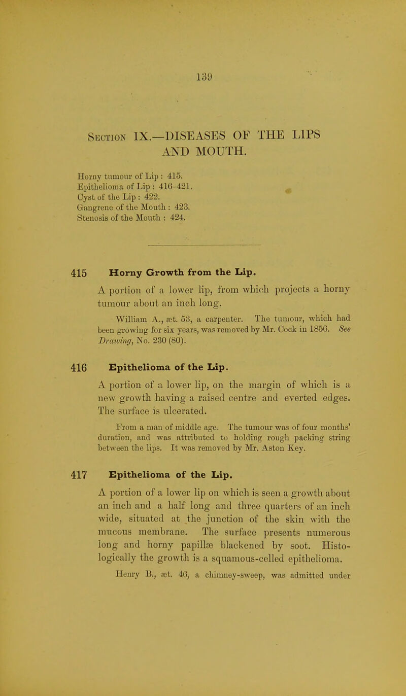 Section IX.—DISEASES OF THE LIPS AND MOUTH. Ilornv tumour of Lip : 415. Epithelioma of Lip : 41G-421. ^ Oyst of tlie Lip : 422. Gaugrene of the Mouth : 423. Stenosis of the Mouth : 424. 415 Horny Growth from the Lip. A portion of a lower lip, from which projects a horny tumour about an inch long. William A., ait. 53, a carpenter. The tiunom-, which had Leen growing for six years, was removed by Mr. Cock in 185G. See Dnaving, No. 230 (80). 416 Epithelioma of the Lip. A portion of a lower lip, on the margin of which is a new growth having a raised centre and everted edges. The surface is ulcerated. From a man of middle age. The tumour was of four months' duration, and was attributed to holding rough packing string between the lips. It was removed by Mr. Aston Key. 417 Epithelioma of the Lip. A portion of a lower lip on which is seen a growth about an inch and a half long and three quarters of an inch wide, situated at the junction of the skin with the mucous membrane. The surface presents numerous long and horny papillae blackened by soot. Histo- logically the growth is a squamous-celled epithelioma. Henry 13., ret. 40, a cliimney-sweep, was admitted under