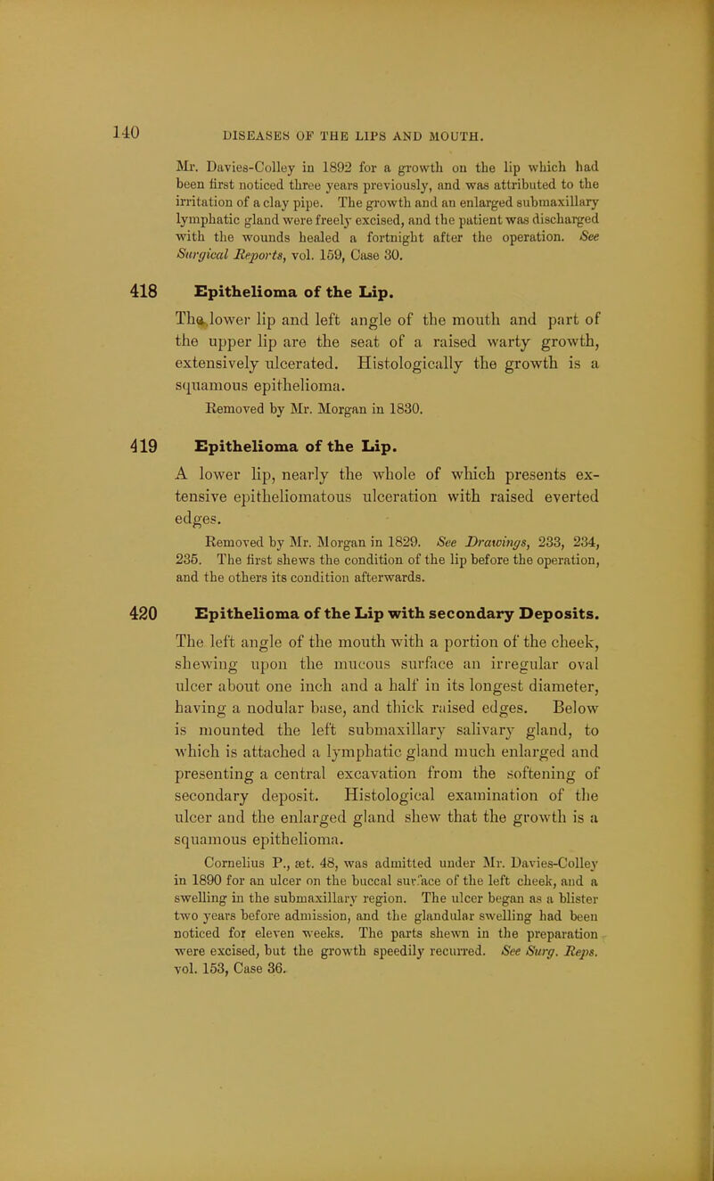 DISEASES OF THE LIPS AND MOUTH. Mi\ Davies-CoUey in 1892 for a growth on the lip which had been first noticed three years previously, and was attributed to the irritation of a clay pipe. The growth and an enlarged submaxillary lymphatic gland were freely excised, and the patient was discharged with the wounds healed a fortnight after the operation. See Surgical Reports, vol. 159, Case 30, Epithelioma of the Lip. Th^.lower lip and left angle of the mouth and part of the upper lip are the seat of a raised warty growth, extensively ulcerated. Histologically the growth is a S(j[uamous epithelioma. Kemoved by Mr. Morgan in 1830. Epithelioma of the Lip. A lower lip, nearly the whole of which presents ex- tensive epitheliomatous ulceration with raised everted edges. Removed by Mr. Morgan in 1829. See Drawings, 233, 234, 235. The tirst shews the condition of the lip before the operation, and the others its condition afterwards. Epithelioma of the Lip with secondary Deposits. The left angle of the mouth with a portion of the cheek, shewing upon the mucous surface an irregular oval ulcer about one inch and a half in its longest diameter, having a nodular base, and thick raised edges. Below is mounted the left submaxillary salivary gland, to which is attached a lymphatic gland much enlarged and presenting a central excavation from the softening of secondary deposit. Histological examination of tlie ulcer and the enlarged gland shew that the growth is a squamous epithelioma. Cornelius P., set. 48, was admitted under Mr. Davies-Colley in 1890 for an ulcer on the buccal suv.ace of the left cheek, and a swelling in the submaxillary region. The ulcer began as a blister two years before admission, and the glandular swelling had been noticed for eleven weeks. The parts shewn in the preparation - were excised, but the growth speedily recurred. See Surg. Heps. vol. 153, Case 36.