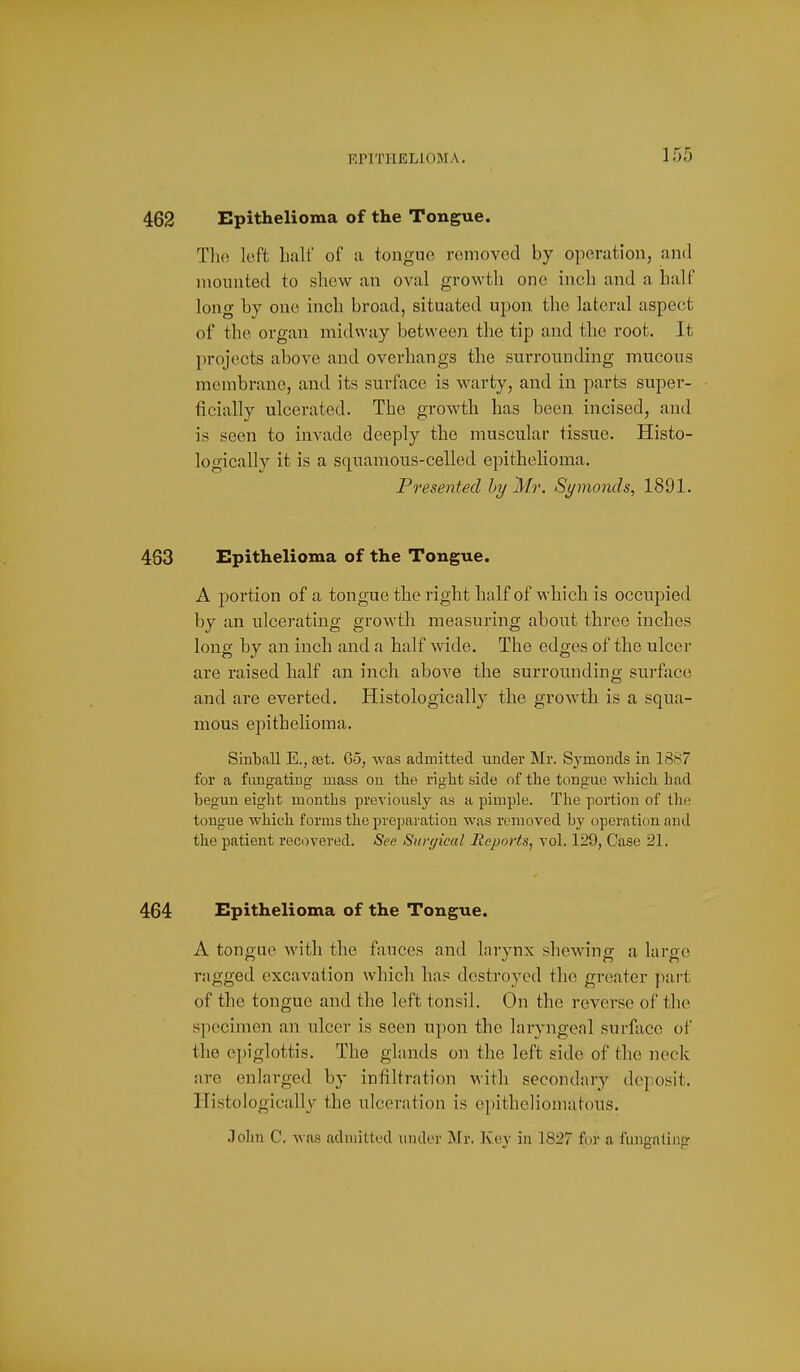 EPITHELIOMA. 462 Epithelioma of the Tongue. Tlie left ball' of a tongue removed by operation, and mounted to sbew an oval growtli one incb and a balf long by one incb broad, situated upon tbe lateral aspect of the organ midway between the tip and the root. It projects above and overhangs the surrounding mucous membrane, and its surface is warty, and in parts super- ficially ulcerated. The growth has been incised, and is seen to invade deeply the muscular tissue. Histo- logically it is a squamous-celled epithelioma. Presented hy Mr. Si/monds, 1891. 463 Epithelioma of the Tongue. A portion of a tongue tbe right half of which is occupied by an ulcerating growth measuring about three inches long by an inch and a half wide. The edges of tbe ulcer are raised half an inch above the surrounding surface and are everted. Histologically the growth is a squa- mous epithelioma. SinbaE E., set. 65, was admitted under Mr. Symonds in 1887 for a fimgating mass on the right side of the tongue which had begun eight months previously as a pimple. The portion of Iho tongue which forms the prepai ation was removed hy operation and the patient recovered. See Suryical Reports, vol. 129, Case 21. 464 Epithelioma of the Tongue. A tongue with the fauces and larynx shewing a large ragged excavation which ba? destroyed the greater jiart of the tongue and the left tonsil. On the reverse of the specimen an ulcer is seen upon the laryngeal surface of the epiglottis. The glands on the left side of tbe neck are enlarged by infiltration with secondary deposit. Histologically the ulceration is epitheliomatous, John C. was admitted under Mr. Key iu 1827 for a fimgating