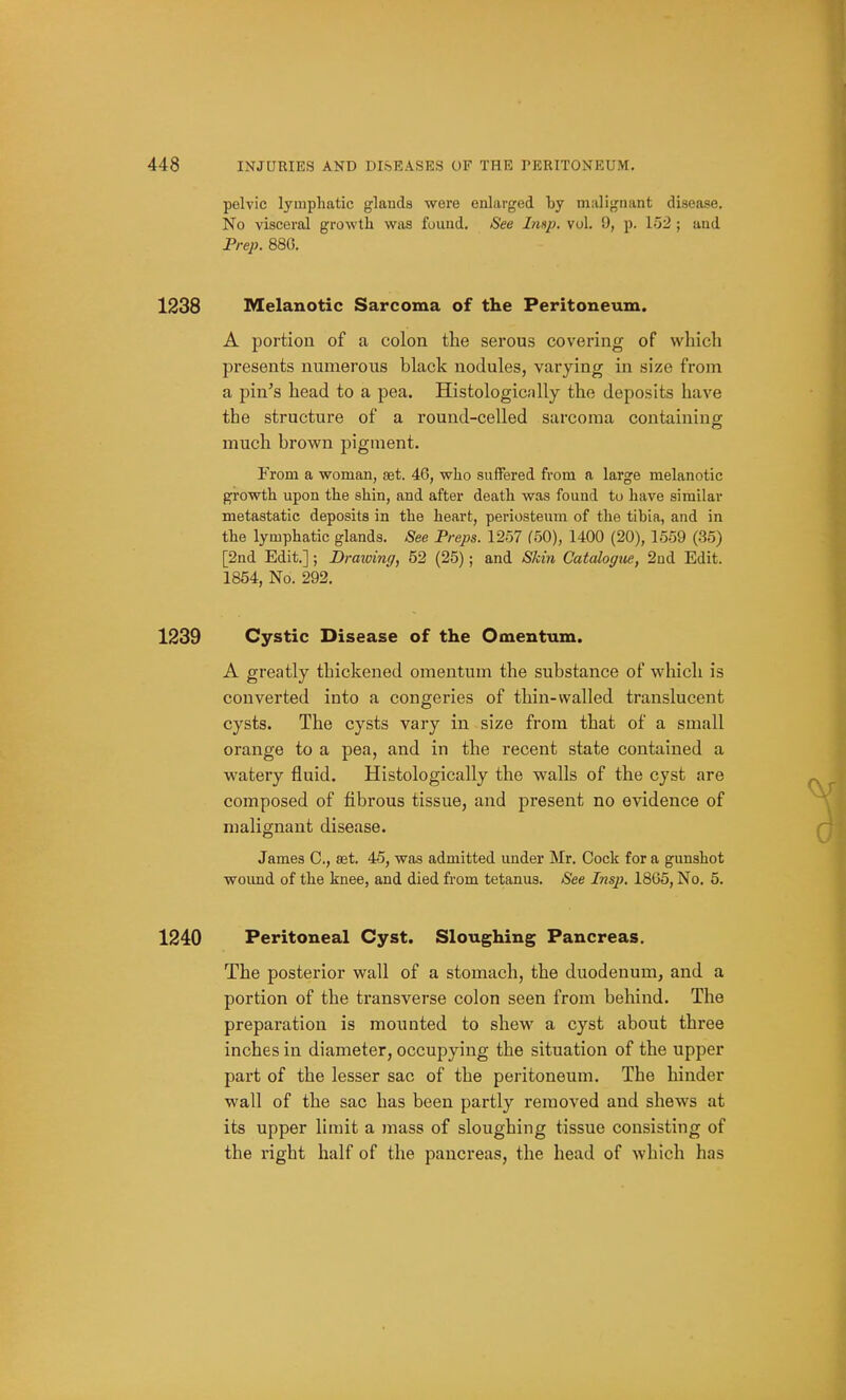 pelvic lymphatic glands were enlarged by malignant disease. No visceral growth was found. See Imp. vol. 9, p. \^y2 ; and Frep. 880. 1238 Melanotic Sarcoma of the Peritoneum. A ijortiou of a colon the serous covering of which presents numerous black nodules, varying in size from a pin's head to a pea. Histologicilly the deposits have the structure of a round-celled sarcoma containinff much brown pigment. From a woman, aet. 46, who suffered from a large melanotic growth upon the shin, and after death was found to have similar metastatic deposits in the heart, periosteum of tlie tibia, and in the lymphatic glands. See Preps. 1257 (50), 1400 (20), 1559 (35) [2nd Edit.]; Draioing, 52 (25); and Skin Catalogue, 2nd Edit. 1854, No. 292. 1239 Cystic Disease of the Omentum. A greatly thickened omentum the substance of which is converted into a congeries of thin-walled translucent cysts. The cysts vary in size from that of a small orange to a pea, and in the recent state contained a watery fluid. Histologically the walls of the cyst are composed of fibrous tissue, and present no evidence of malignant disease. James C, set. 45, was admitted under Mr. Cock for a gunshot wound of the knee, and died from tetanus. See Insp. 1805, No. 5. 1240 Peritoneal Cyst. Sloughing Pancreas. The posterior wall of a stomach, the duodenum, and a portion of the transverse colon seen from behind. The preparation is mounted to shew a cyst about three inches in diameter, occupying the situation of the upper part of the lesser sac of the peritoneum. The hinder wall of the sac has been partly removed and shews at its upper limit a mass of sloughing tissue consisting of the right half of the pancreas, the head of which has