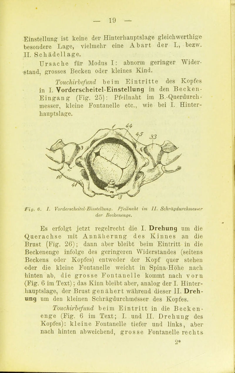 Einstellung ist keine der Hinterhauptslage gleichwerthige besondere Lage, vielmehr eine Abart der I., bezv\. II. Schädenage. Ursache für Modus I: abnorm geringer Wider- stand, grosses Becken oder kleines Kind. Touchirbefund beim Eintritte des Kopfes in I. Vorderscheitel-Einstellung in den Becken- Eingang (Fig. 25): Pfeiliiaht im B.-Querdurch- messer, kleine Fontanelle etc., wie bei I. Hiuter- liauptslage. Fig. 6. 1. Vorderscheifel-Eiiiilelbing. Pfeilnaht im 11. Schrägdwclimeaher der ßeckenenge. Es erfolgt jetzt regelrecht die I. Drehung um die Querachse mit Annäherung des Kinnes an die Brust (Fig. 26); dann aber bleibt beim Eintritt in die Beckeneuge infolge des geringeren Widerstandes (seitens Beckens oder Kopfes) entweder der Kopf quer stehen oder die kleine Fontanelle weicht in Spina-Höhe nach hinten ab, die grosse Fontanelle kommt nach vorn (Fig. 6 im Text); das Kinn bleibt aber, analog der I. Hinter- hauptslage, der Brust genähert wälu’eud dieser II. Dreh- ung um den kleinen Schrägdurchmösser des Kopfes. Touchirbefund beim Eintritt in die Becken- enge (Fig. 6 im Text; I. und II. Drehung des Kopfes): kleine Fontanelle tiefer und links, aber nach hinten abweichend, grosse Fontanelle rechts 2*