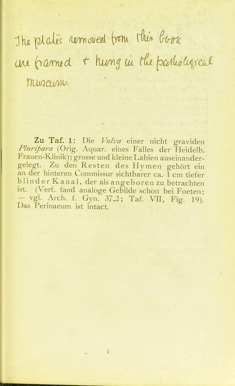 f)Ui/oai/>u/. Zu Taf. 1: Die Pulva einer nicht graviden Pluripara (Orig. Aquar. eines Falles der Heidelb. Frauen-Klinik); grosse und kleine Labien auseinander- gelegt. Zu den Resten des Hymen gehört ein an der hinteren Commissur sichtbarer ca. 1 cm tiefer blinder Kanal, der als angeboren zu betrachten ist. (Verf. fand analoge Gebilde schon bei Foeten; — vgl. Arch. f. Gyn. 37,2; Taf. Fig. 19). Das Perinaeum ist intact.