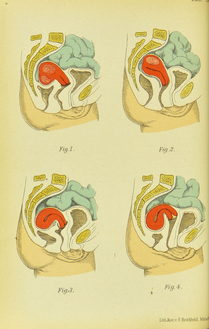 LithÄist.v. F. Ri'ichhold. Miiml