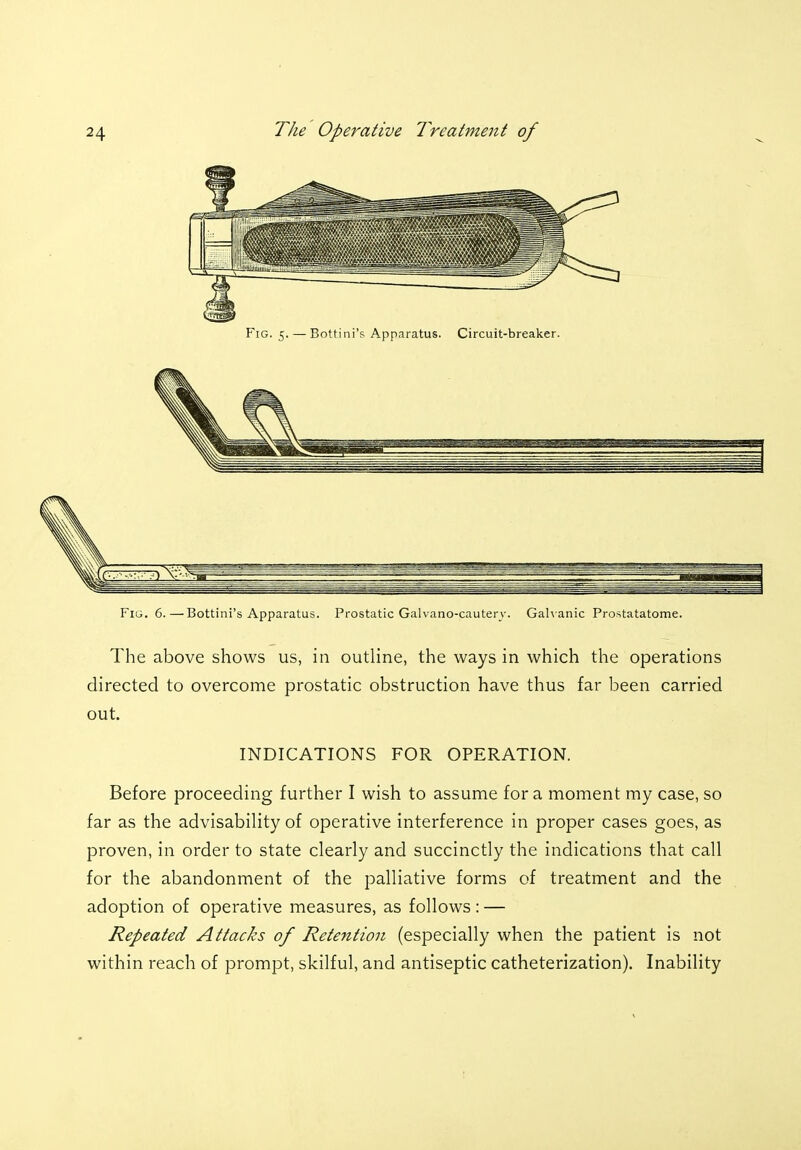 Fig. 5. — Bottini's Apparatus. Circuit-breaker. Fig. 6.—Bottini's Apparatus. Prostatic Galvano-cautery. Galvanic Prostatatome. The above shows us, in outline, the ways in which the operations directed to overcome prostatic obstruction have thus far been carried out. INDICATIONS FOR OPERATION. Before proceeding further I wish to assume for a moment my case, so far as the advisability of operative interference in proper cases goes, as proven, in order to state clearly and succinctly the indications that call for the abandonment of the palliative forms of treatment and the adoption of operative measures, as follows: — Repeated Attacks of Retention (especially when the patient is not within reach of prompt, skilful, and antiseptic catheterization). Inability