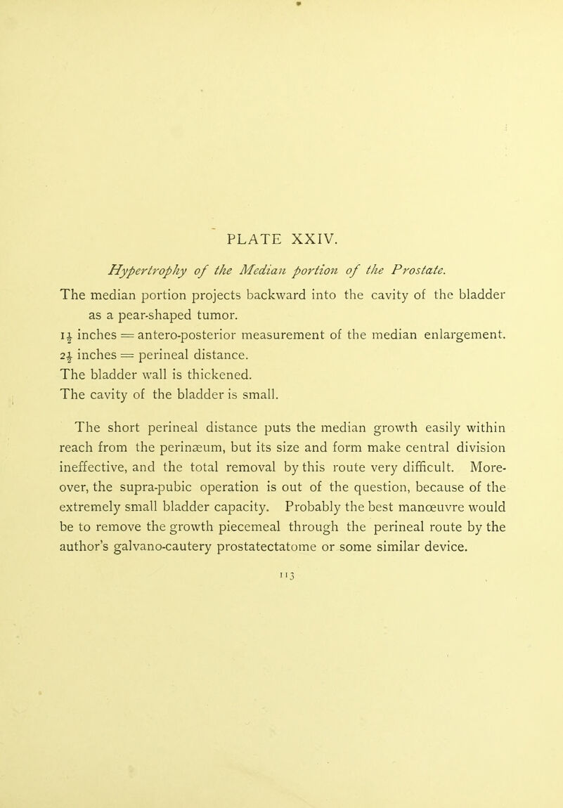 Hypertrophy of the Median portion of the Prostate. The median portion projects backward into the cavity of the bladder as a pear-shaped tumor. i£ inches = antero-posterior measurement of the median enlargement. 2\ inches = perineal distance. The bladder wall is thickened. The cavity of the bladder is small. The short perineal distance puts the median growth easily within reach from the perinseum, but its size and form make central division ineffective, and the total removal by this route very difficult. More- over, the supra-pubic operation is out of the question, because of the extremely small bladder capacity. Probably the best manoeuvre would be to remove the growth piecemeal through the perineal route by the author's galvano-cautery prostatectatome or some similar device. 3