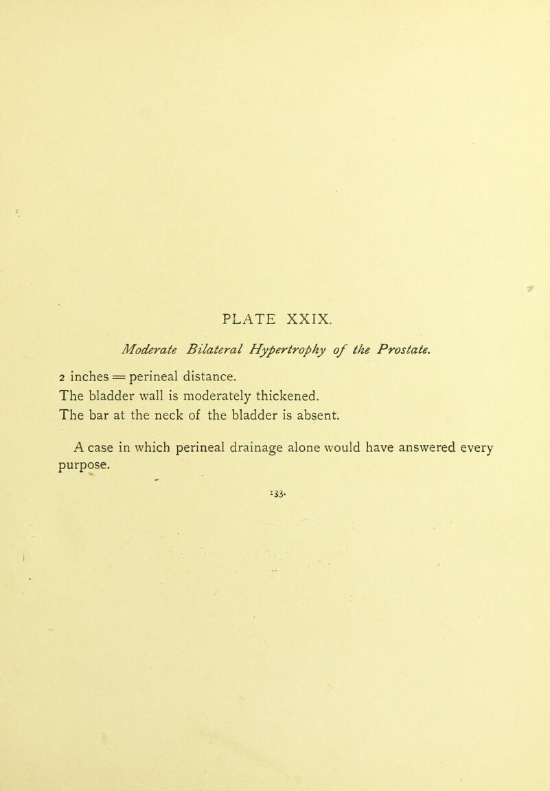 Moderate Bilateral Hypertrophy of the Prostate. 2 inches == perineal distance. The bladder wall is moderately thickened. The bar at the neck of the bladder is absent. A case in which perineal drainage alone would have answered every purpose. 133-