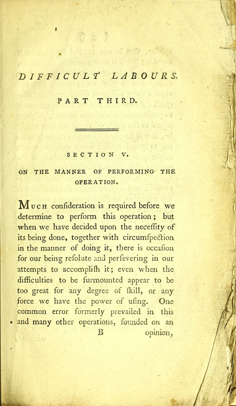 » difficult labours; PART THIRD. SECTION V. ON THE MANNER OF PERFORMING THE OPERATION. M uch consideration is required before we determine to perform this operation; but when we have decided upon the neceffity of its being done, together with circumfpeftion in the manner of doing it, there is occafion for our being refolute and perfevering in our attempts to accompli (h it; even when the difficulties to be furmounted appear to be too great for any degree of {kill, or any force we have the power of ufing. One common error formerly prevailed in this • and many other operations, founded on an B opinion.