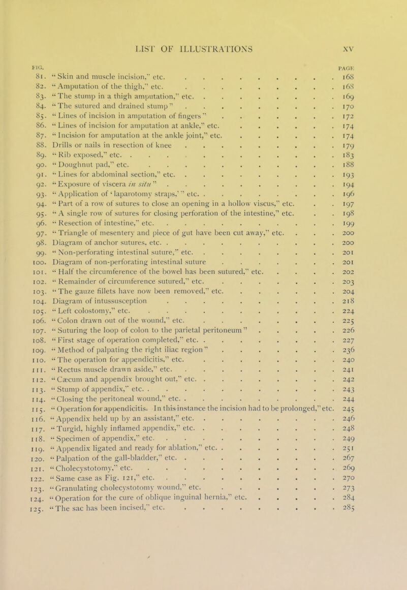 FIG. PAGF. Si.  Skin and muscle incision. etc. 16S 82. Amputation of the thigh, etc. 16S 83.  The stump in a thigh amputation. etc. 169 84.  The sutured and drained stump  .170 85.  Lines of incision in amputation of fingers  ....... 172 86.  Lines of incision for amputation at ankle, etc. . . . . . .174 87.  Incision for amputation at the ankle joint, etc. ...... 174 88. Drills or nails in resection of knee 179 89. •• Rib exposed. etc. . . . 183 90. Doughnut pad,'1 etc. 188 91.  Lines for abdominal section, etc. ......... 193 92.  Exposure of viscera in situ11 . . . . . . . . . .194 93.  Application of ' laparotomy straps.' etc. ........ 196 94.  Part of a row of sutures to close an opening in a hollow viseus, etc. . . 197 95. A single row of sutures for closing perforation of the intestine, etc. . . 198 96. •• Resection of intestine. etc. .......... 199 97. -Triangle of mesentery and piece of gut have been cut away, etc. . . . 200 98. Diagram of anchor sutures, etc. .......... 200 99.  Non-perforating intestinal suture, etc. . . . . . . . .201 100. Diagram of non-perforating intestinal suture ....... 201 101.  Half the circumference of the bowel has been sutured. etc. .... 202 102. •• Remainder of circumference sutured, etc. ....... 203 103. •■ The gauze fillets have now been removed, etc. ...... 204 104. Diagram of intussusception .......... 218 105.  Left colostomy, etc. 224 106.  Colon drawn out of the wound, etc. ........ 225 107. •• Suturing the loop of colon to the parietal peritoneum 226 108. First stage of operation completed, etc. ........ 227 109.  Method of palpating the right iliac region 236 no.  The operation for appendicitis, etc. . 240 in. •• Rectus muscle drawn aside. etc. . 241 112. -'Caecum and appendix brought out. etc 242 113.  Stump of appendix, etc 243 114. Closing the peritoneal wound, etc 244 115.  Operation for appendicitis. In this instance the incision had to be prolonged. etc. 245 116.  Appendix held up by an assistant, etc 246 117. Turgid, highly inflamed appendix. etc 248 118.  Specimen of appendix, etc 249 119. Appendix ligated and ready for ablation, etc 251 120.  Palpation of the gall-bladder, etc 267 121.  Cholecystotomy. etc 269 122.  Same case as Fig. 121, etc 270 123. Granulating cholecystotomy wound. etc. 273 124. Operation for the cure of oblique inguinal hernia. etc 284 125. The sac has been incised. etc. 285