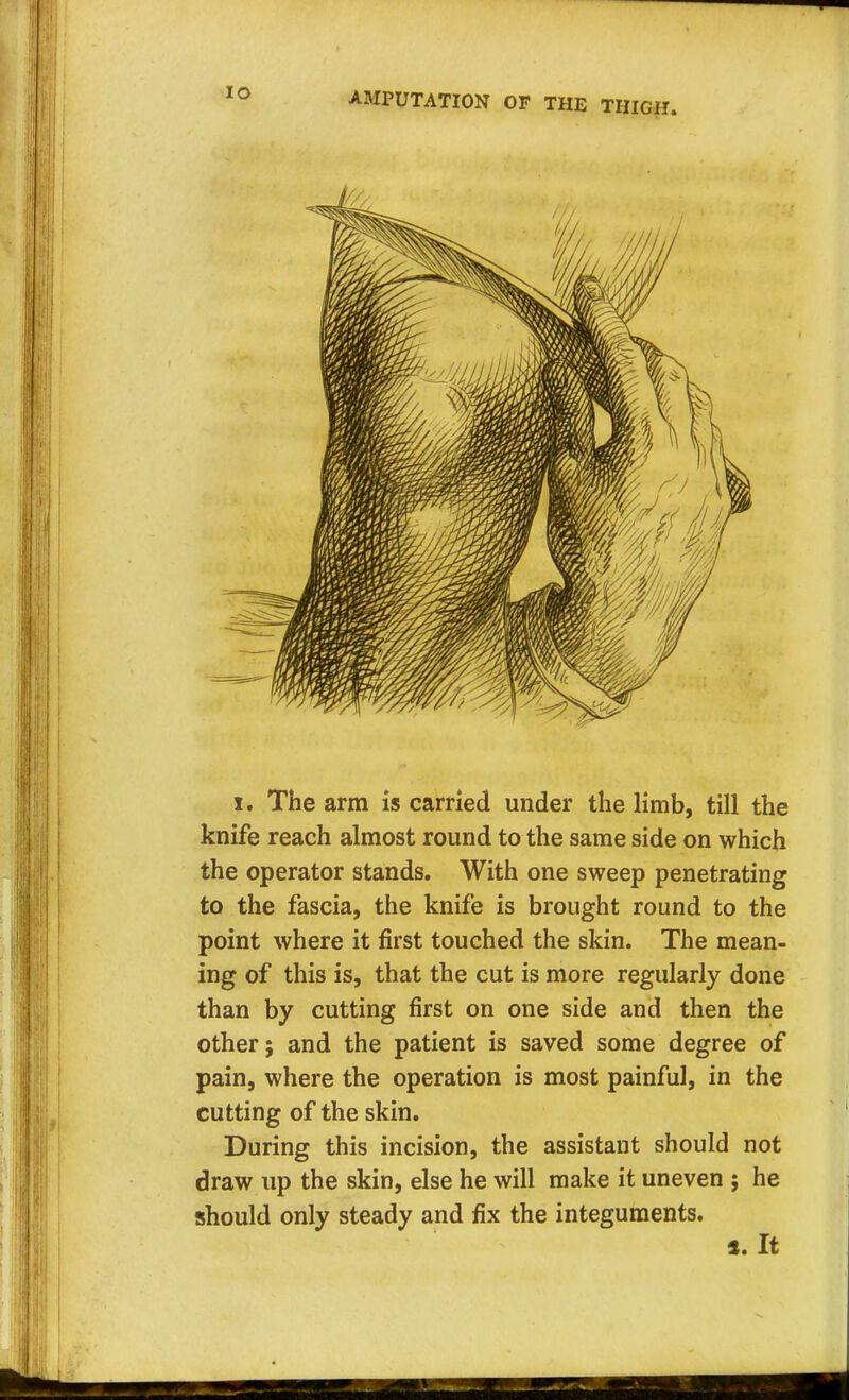 it The arm is carried under the limb, till the knife reach almost round to the same side on which the operator stands. With one sweep penetrating to the fascia, the knife is brought round to the point where it first touched the skin. The mean- ing of this is, that the cut is more regularly done than by cutting first on one side and then the other; and the patient is saved some degree of pain, where the operation is most painful, in the cutting of the skin. During this incision, the assistant should not draw up the skin, else he will make it uneven ; he should only steady and fix the integuments. s. It
