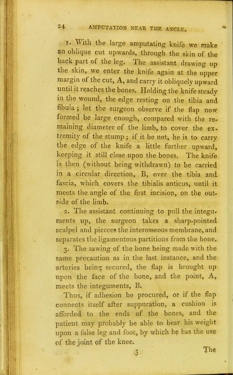 1. With the large amputating knife we make an oblique cut upwards, through the skin of the back part of the leg. The assistant drawing up the skin, we enter the knife again at the upper margin of the cut, A, and carry it obliquely upward until it reaches the bones. Holding the knife steady in the wound, the edge resting on the tibia and fibula ; let the surgeon observe if the flap now formed be large enough, compared with the re- maining diameter of the limb, to cover the ex- tremity of the stump ; if it be not, he is to carry the edge of the knife a little further upward, keeping it still close upon the bones. The knife is then (without being withdrawn) to be carried in a circular direction, B, over the tibia and. fascia, which covers the tibialis anticus, until it meets the angle of the first incision, on the out- side of the limb. 2. The assistant continuing to pull the integu- ments up, the surgeon takes a sharp-pointed scalpel and pierces the interosseous membrane, and separates the ligamentous partitions from the bone. - 3. The sawing of the bone being made with the same precaution as in the last instance, and the arteries being secured, the flap is brought up upon the face of the bone, and the point, A, meets the integuments, B. Thus, if adhesion be procured, or if the flap connects itself after suppuration, a cushion is afforded to the ends of the bones, and the patient may probably be able to bear his weight upon a false leg and foot, by which he has the use of the joint of the knee.