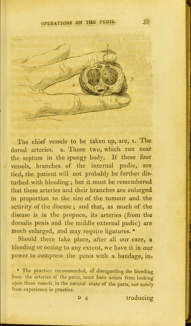 The chief vessels to be taken up, are, i. The dorsal arteries, i. Those two, which run near the septum in the spongy body. If these four vessels, branches of the internal pudic, are tied, the patient will not probably be further dis- turbed with bleeding ; but it must be remembered that these arteries and their branches are enlarged in proportion to the size of the tumour and the activity of the disease ; and that, as much of the disease is in the prepuce, its arteries (from the dorsalis penis and the middle external pudic) are much enlarged, and may require ligatures. * Should there take place, after all our care, a bleeding or oozing to any extent, we have it in our power to compress the penis with a bandage, in- * The practice recommended, of disregarding the bleeding from the arteries of the penis, must have arisen from looking upon these vessels in the natural state of the parts, not 6urely from experience in practice. d 4 troducing