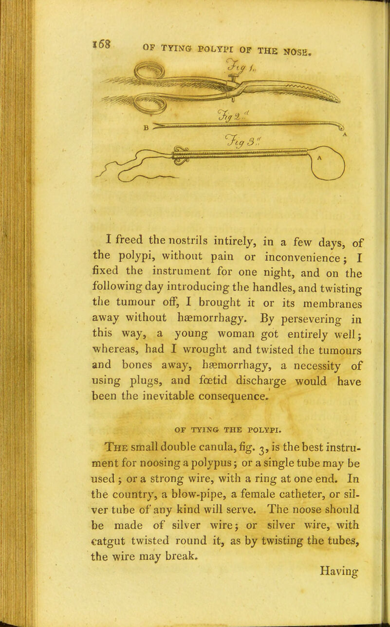 the polypi, without pain or inconvenience; I fixed the instrument for one night, and on the following day introducing the handles, and twisting the tumour off, I brought it or its membranes away without haemorrhagy. By persevering in this way, a young woman got entirely well; whereas, had I wrought and twisted the tumours and bones away, haemorrhagy, a necessity of using plugs, and foetid discharge would have been the inevitable consequence. OF TYING THE POLYPI. The small double canula, fig. 3, is the best instru- ment for noosing a polypus; or a single tube may be used ; or a strong wire, with a ring at one end. In the country, a blow-pipe, a female catheter, or sil- ver tube of any kind will serve. The noose should be made of silver wire; or silver wire, with catgut twisted round it, as by twisting the tubes, the wire may break. Having