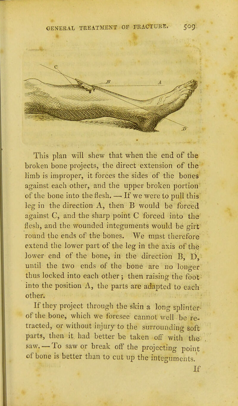 This plan will shew that when the end of the broken bone projects, the direct extension of the limb is improper, it forces the sides of the bones against each other, and the upper broken portion of the bone into the flesh. —. If we were to pull this leg in the direction A, then B would be forced against C, and the sharp point C forced into the flesh, and the wounded integuments would be girt round the ends of the bones. We must therefore extend the lower part of the leg in the axis of the lower end of the bone, in the direction B, D, until the two ends of the bone are no longer thus locked into each other; then raising the foot into the position A, the parts are adapted to each other. If they project through the skin a long splinter- of the bone, which we foresee cannot well be re- tracted, or without injury to the surrounding soft parts, then it had better be taken off with the saw. —To saw or break oft'the projecting point of bone is better than to cut up the integuments. If