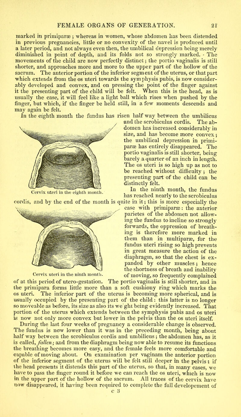 marked iti priniiparas ; whereas in women, whose abdomen has been distended in previous pregnancies, little or no convexity of the navel is produced until a later period, and not always even then, the umbilical depression being merely diminished in point of depth, and its folds not so strongly marked. - The movements of the child are now perfectly distinct; the portio vaginalis is still shorter, and approaches more and more to the upper part of the hollow of the sacrum. The anterior portion of the inferior segment of the uterus, or that part which extends from the os uteri towards the symphysis pubis, is now consider- ably developed and convex, and on pressing the point of the finger against it the presenting part of the child will be felt. When this is the head, as is usually the case, it will feel like a light ball which rises when pushed by the finger, but which, if the finger be held still, in a few moments descends and may again be felt. In the eighth month the fundus has risen half way between the umbilicus and the scrobiculus cordis. The ab- domen has increased considerably in size, and has become more convex; the umbilical depression in primi- parae has entirely disappeared. The portio vaginalis is still shorter, being barely a quarter of an inch in length. The os uteri is so high up as not to be reached without difficulty ; the presenting part of the child can be distinctly felt. In the ninth month, the fundus has reached nearly to the scrobiculus cordis, and by the end of the month is quite in it; this is more especially the case with primiparse: the anterior parietes of the abdomen not alloAv- ing the fundus to incline so strongly forwards, the oppression of breath- ing is therefore more marked in tbem than in multipara;, for the fundus uteri rising so high prevents in great measure the action of the diaphragm, so that the chest is ex- panded by other muscles ; hence the shortness of breath and inability Cervix uteri in the ninth month. 0f m0ving, so frequently complained of at this period of utero-gestation. The portio vaginalis is still shorter, and in the primipara forms little more than a soft cushiony ring which marks the os uteri. The inferior part of the uterus is becoming more spherical, and is usually occupied by the presenting part of the child: this latter is no longer so moveable as before, its size as also its we'ght being evidently increased. That portion of the uterus which extends between the symphysis pubis and os uteri is now not only more convex but lower in the pelvis than the os uteri itself. During the last four weeks of pregnancy a considerable change is observed. The fundus is now lower than it was in the preceding month, being about half way between the scrobiculus cordis and umbilicus ; the abdomen has, as it is called, fallen; and from the diaphragm being now able to resume its functions the breathing becomes more easy, and the female feels more comfortable and capable of moving about. On examination per vaginam the anterior portion of the inferior segment of the uterus will be felt still deeper in the pelvis; if the head presents it distends this part of the uterus, so that, in many cases, we have to pass the finger round it before we can reach the os uteri, which is now in the upper part of the hollow of the sacrum. All traces of the cervix have now disappeared, it having been required to complete the full developement of Cervix uteri in the eighth month.