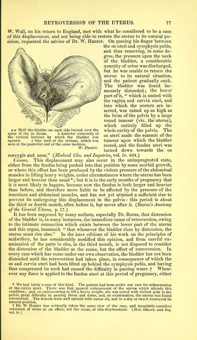 W. Wall, on his return to England, met with what he considered to be a case of this displacement, and not being able to restore the uterus to its natural po- sition, requested the advice of Dr. W. Hunter. On passing his finger between the os uteri and symphysis pubis, and thus removing, in some de- gree, the pressure upon the neck of the bladder, a considerable quantity of urine was discharged, but he was unable to return the uterus to its natural situation, and the patient gradually sunk. The bladder was found im- mensely distended; the lower part of it, which is united with the vagina and cervix uteri, and into which the ureters are in- serted, was raised up as high as the brim of the pelvis by a large round tumour (viz. the uterus), which entirely filled up the whole cavity of the pelvis. The os uteri made the summit of the tumour upon which the bladder rested, and the fundus uteri was turned down towards the os coccygis and anus. {Medical Ohs. and Inquiries, vol. iv. 404.) Causes. This displacement may also occur in the unimpregnated state, either from the fundus being pushed into that position by some morbid growth, or where this effect has been produced by the violent pressure of the abdominal muscles in lifting heavy weights, under circumstances where the uterus has been larger and heavier than usual *; but it is in the early months of pregnancy that it is most likely to happen, because now the fundus is both larger and heavier than before, and therefore more liable to be affected by the pressure of the intestines and abdominal muscles, and has not yet attained a sufficient size to prevent its undergoing this displacement in the pelvis : this period is about the third or fourth month, often before it, but never after it. (Burns's Anatomy of the Gravid Uterus, p. 17.) It has been supposed by many authors, especially Dr. Burns, that distension of the bladder is, in many instances, the immediate cause of retroversion, owing to the intimate connection which exists between the lower part of the uterus and this organ, inasmuch that whenever the bladder rises by distension, the uterus must rise also. In the later editions of his work on the principles of midwifery, he has considerably modified this opinion, and from careful ex- amination of the parts in situ, in the third month, is not disposed to consider the distension of the bladder as the cause, but the effect of retroversion. In every case which has come under our own observation, the bladder has not been distended until the retroversion had taken place, in consequence of which the os and cervix uteri had been tilted up behind the symphysis pubis, and having thus compressed its neck had caused the difficulty in passing water, f When- ever any force is applied to the fundus uteri at this period of pregnancy, either * We had lately a case of this kind. The patient had been under our care for inflammation of the cervix uteri. There was that general enlargement of the uterus which attends this condition ; and, on endeavouring to lift a heavy weight, she was seized with violent pain in the pelvis, great difficulty in passing faeces and urine, and, on examination, the uterus was found retroverted. The bowels were well opened with castor oil, and in a day or two it recovered its natural position. t Dr. W. Hunter has evidently taken the same view of the case, and invariably considers retention of urine as an effect, not the cause, of this displacement. (Med. Obscrv. and Inq. vol. iv.) a a Half the bladder on each side turned over the spine of the os ileum, b Anterior extremity of the vertical incision by which the bladder was opened. c One turn of the rectum, which was seen at the posterior end of the same incision. W. Hunter.