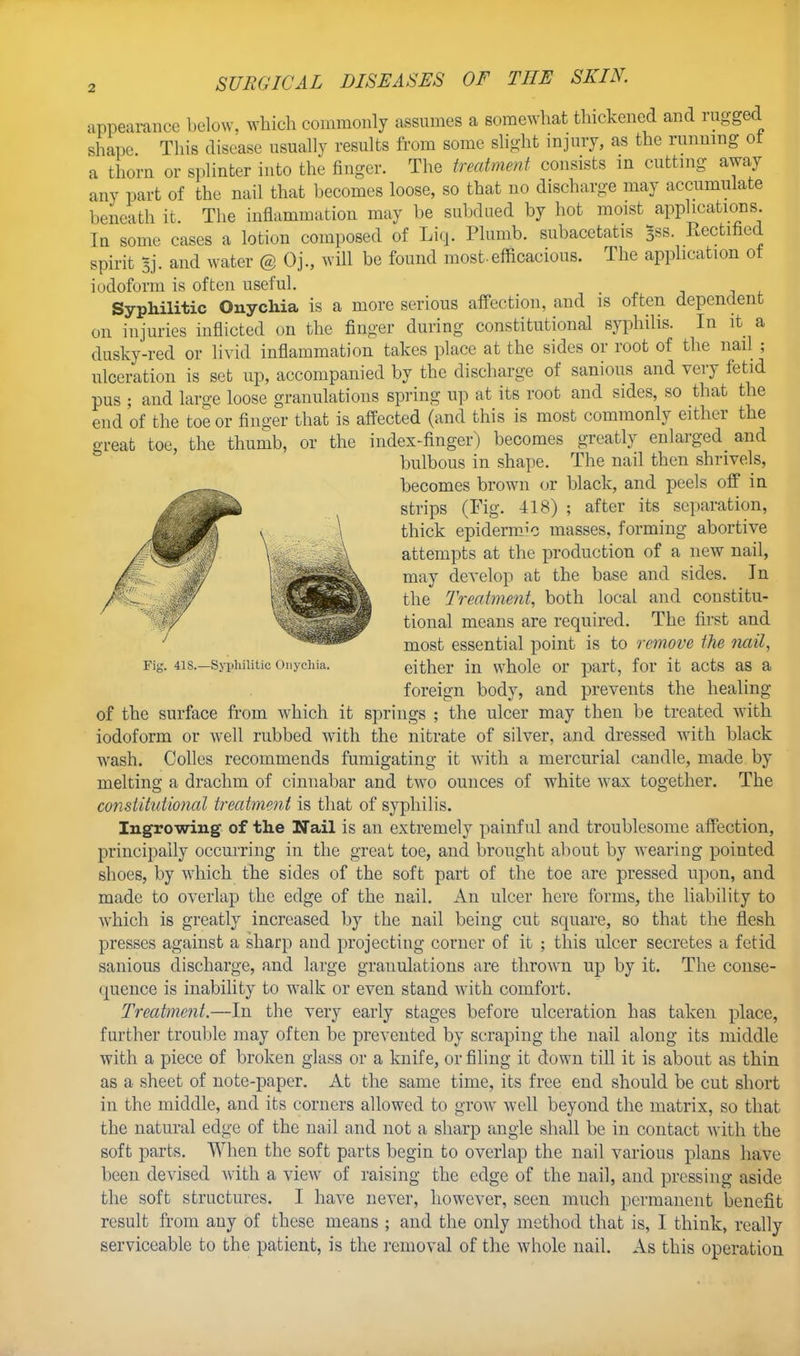 appearance below, which commonly assumes a somewhat thickened and rugged shape. This disease usually results from some slight injury, as the running ot a thorn or splinter into the finger. The treatment consists m cutting away any part of the nail that becomes loose, so that no discharge may accumulate beneath it The inflammation may be subdued by hot moist applications In some cases a lotion composed of Liq. Plumb, subacetatis Bss. Rectified spirit sj. and water @ Oj., will be found most-efficacious. The application of iodoform is often useful. Syphilitic Onychia is a more serious affection, and is often dependent on injuries inflicted on the finger during constitutional syphilis. In it a dusky-red or livid inflammation takes place at the sides or root of the nail ; ulceration is set up, accompanied by the discharge of sanious and very fetid pus ; and large loose granulations spring up at its root and sides, so that the end of the toe or finger that is affected (and this is most commonly either the great toe, the thumb, or the index-finger) becomes greatly enlarged and bulbous in shape. The nail then shrivels, e^—..^ becomes brown or black, and peels off in strips (Fig. 418) ; after its separation, thick epidermJc masses, forming abortive attempts at the production of a new nail, may develop at the base and sides. In the Treatment, both local and constitu- tional means are required. The first and most essential point is to remove the nail, Fig. 4is.—syphilitic Onychia. either in whole or part, for it acts as a foreign body, and prevents the healing of the surface from Avhich it springs ; the ulcer may then be treated with iodoform or well rubbed wdth the nitrate of silver, and dressed with black wrash. Colles recommends fumigating it with a mercurial candle, made by melting a drachm of cinnabar and two ounces of white wax together. The constitutional treatment is that of syphilis. Ingrowing of the Nail is an extremely painful and troublesome affection, principally occurring in the great toe, and brought about by wearing pointed shoes, by which the sides of the soft part of the toe are pressed upon, and made to overlap the edge of the nail. An ulcer here forms, the liability to which is greatly increased by the nail being cut square, so that the flesh presses against a sharp and projecting corner of it ; this ulcer secretes a fetid sanious discharge, and large granulations are thrown up by it. The conse- quence is inability to walk or even stand writh comfort. Treatment.—In the very early stages before ulceration has taken place, further trouble may often be prevented by scraping the nail along its middle with a piece of broken glass or a knife, or filing it down till it is about as thin as a sheet of note-paper. At the same time, its free end should be cut short in the middle, and its corners allowed to grow well beyond the matrix, so that the natural edge of the nail and not a sharp angle shall be in contact with the soft parts. When the soft parts begin to overlap the nail various plans have been devised with a view of raising the edge of the nail, and pressing aside the soft structures. I have never, however, seen much permanent benefit result from any of these means ; and the only method that is, I think, really serviceable to the patient, is the removal of the whole nail. As this operation