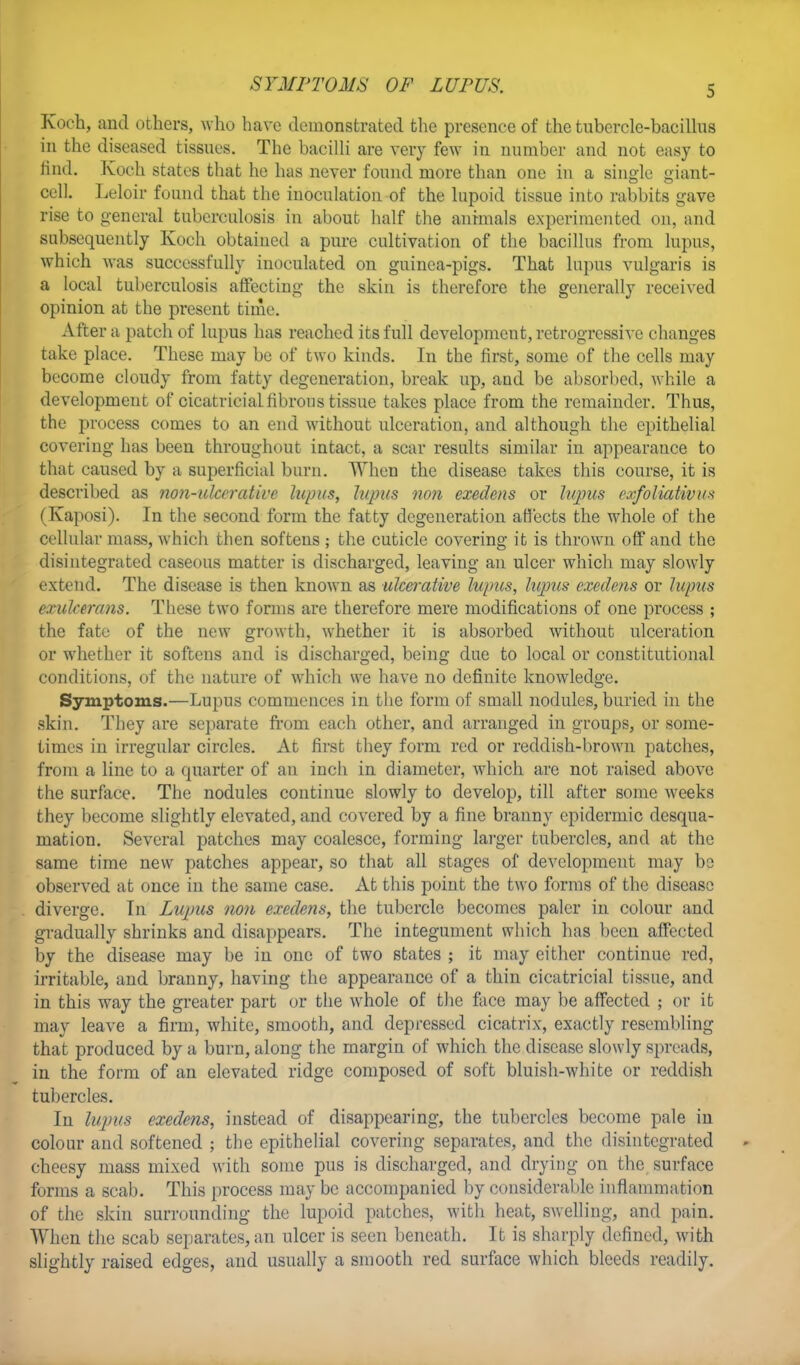 SYMPTOMS OF LUPUS. Koch, and others, who have demonstrated the presence of the tubercle-bacillus in the diseased tissues. The bacilli are very few in number and not easy to find. Koch states that he has never found more than one in a single giant- cell. Leloir found that the inoculation-of the lupoid tissue into rabbits gave rise to general tuberculosis in about half the animals experimented on, and subsequently Koch obtained a pure cultivation of the bacillus from lupus, which was successfully inoculated on guinea-pigs. That lupus vulgaris is a local tuberculosis affecting the skin is therefore the generally received opinion at the present time. After a patch of lupus has reached its full development, retrogressive changes take place. These may be of two kinds. In the first, some of the cells may become cloudy from fatty degeneration, break up, and be absorbed, while a development of cicatricial fibrous tissue takes place from the remainder. Thus, the process comes to an end without ulceration, and although the epithelial covering has been throughout intact, a scar results similar in appearance to that caused by a superficial burn. When the disease takes this course, it is described as non-ulcer'alive lupus, lupus non exedens or lupus exfoliativa* (Kaposi). In the second form the fatty degeneration affects the whole of the cellular mass, which then softens ; the cuticle covering it is thrown off and the disintegrated caseous matter is discharged, leaving an ulcer which may slowly extend. The disease is then known as ulcerative lupus, lupus exedens or lupus exulcerans. These two forms are therefore mere modifications of one process ; the fate of the new growth, whether it is absorbed without ulceration or whether it softens and is discharged, being due to local or constitutional conditions, of the nature of which we have no definite knowledge. Symptoms.—Lupus commences in the form of small nodules, buried in the skin. They are separate from each other, and arranged in groups, or some- times in irregular circles. At first they form red or reddish-brown patches, from a line to a quarter of an inch in diameter, which are not raised above the surface. The nodules continue slowly to develop, till after some weeks they become slightly elevated, and covered by a fine branny epidermic desqua- mation. Several patches may coalesce, forming larger tubercles, and at the same time new patches appear, so that all stages of development may bo observed at once in the same case. At this point the two forms of the disease diverge. In Lupus non exedens, the tubercle becomes paler in colour and gradually shrinks and disappears. The integument which has been affected by the disease may be in one of two states ; it may either continue red, irritable, and branny, having the appearance of a thin cicatricial tissue, and in this way the greater part or the whole of the face may be affected ; or it may leave a firm, white, smooth, and depressed cicatrix, exactly resembling that produced by a burn, along the margin of which the disease slowly spreads, in the form of an elevated ridge composed of soft bluish-white or reddish tubercles. In lupus exedens, instead of disappearing, the tubercles become pale in colour and softened ; the epithelial covering separates, and the disintegrated cheesy mass mixed with some pus is discharged, and drying on the surface forms a scab. This process may be accompanied by considerable inflammation of the skin surrounding the lupoid patches, with heat, swelling, and pain. When the scab separates, an ulcer is seen beneath. It is sharply defined, with slightly raised edges, and usually a smooth red surface which bleeds readily.