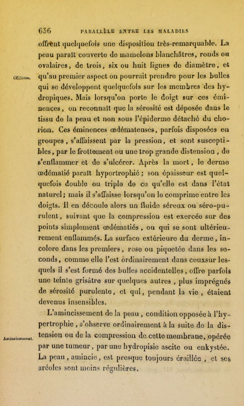 offrent quelquefois une disposition très-remarquable. La peau paraît couverte do mamelons blanchâtres, ronds ou ovalaires, de trois, six ou huit lignes de diamètre, et qu'au premier aspect on pourrait prendre pour les bulles qui se développent quelquefois sur les membres de3 hy- dropiques. Mais lorsqu'on porte le doigt sur ces émi- nences, on reconnaît que la sérosité est déposée dans le tissu do la peau et non sous 1'épiderme détaché du cho- rion. Ces éminences œdémateuses, parfois disposées en groupes, s'affaissent par la pression, et sont suscepti- bles, par le frottement ou une trop grande distension , de s'enflammer et do s'ulcérer. Après la mort, le derme œdématié paraît hypertrophié ; son épaisseur est quel- quefois double ou triple de ce qu'elle est dans l'état naturel; mais il s'affaisse lorsqu'on le comprime entre les doigts. Il en découle alors un fluide séreux ou séro-pu- rulent, suivant que la compression est exercée sur des points simplement œdématiés , ou qui se sont ultérieu- rement enflammés. La surface extérieure du derme, in- colore dans les premiers, rose ou piquetée dans les so- conds, comme elle l'est ordinairement dans ceuxsur les- quels il s'est formé dos bulles accidentelles, offre parfois une teinte grisâtre sur quelques autres , plus imprégnés de sérosité purulente, et qui, pendant la vie , étaient devenus insensibles. L'amincissement do !a peau , condition opposée à l'hy- pertrophie , s'observe ordinairement à la suite de la dis- tension ou de la compression de cette membrane, opérée par une tumeur, par une hydropisie ascite ou enkystée, La peau , amincie, est presque toujours éraillée , et ses aréoles sont moins régulières.